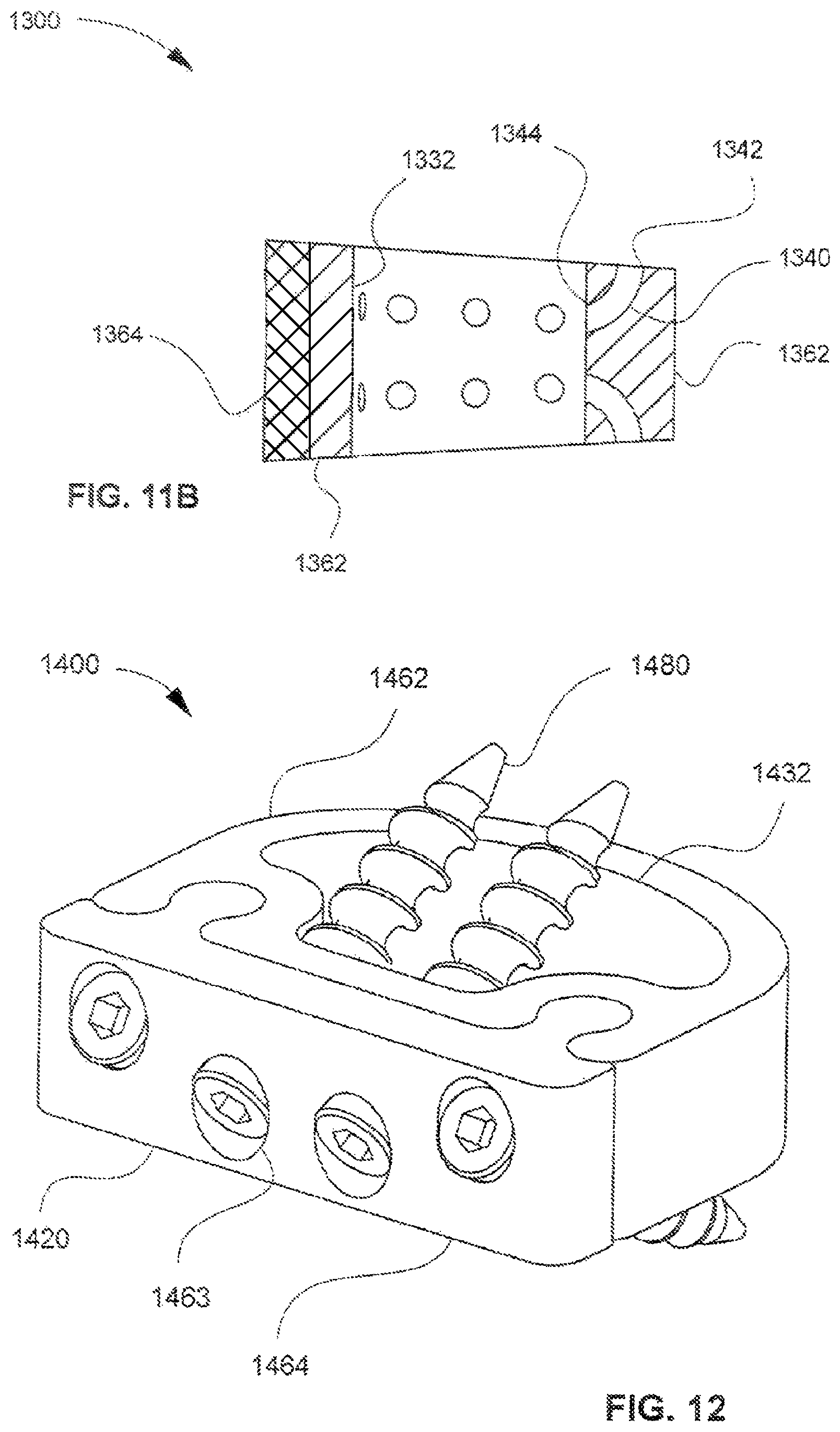 Patent US12318309 Figure 9 – Modular interbody spacer