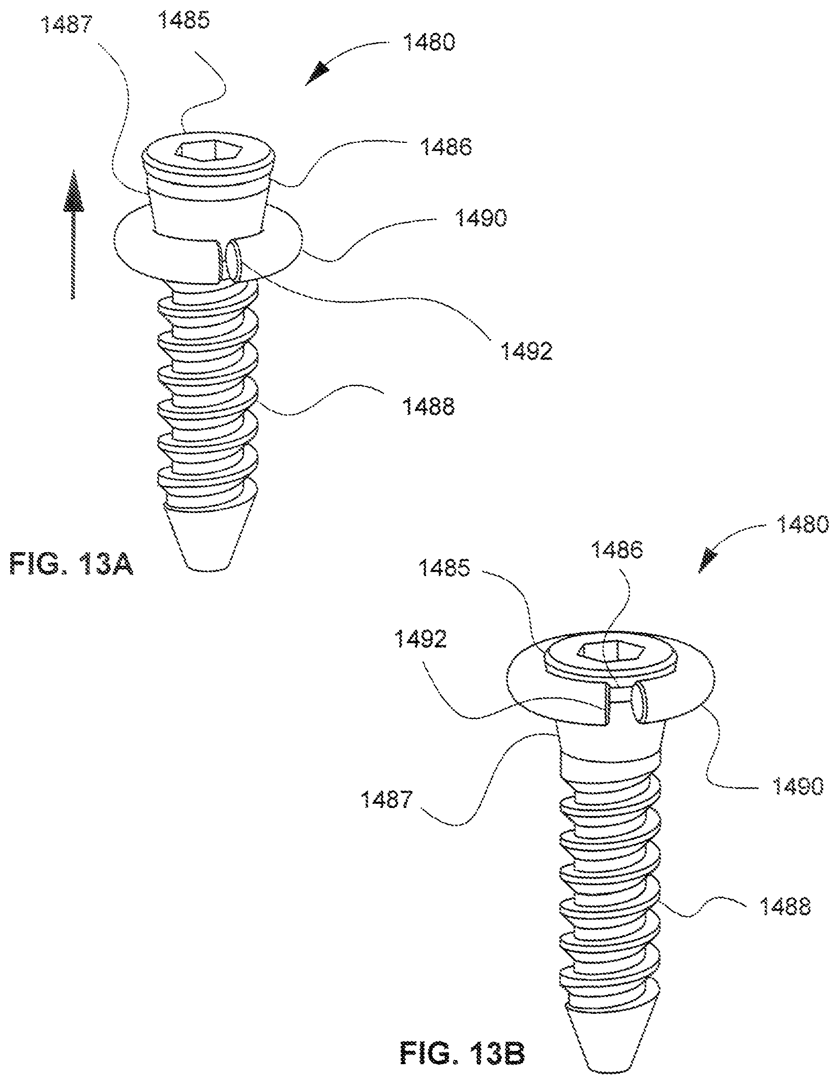 Patent US12318309 Figure 10 – Modular interbody spacer