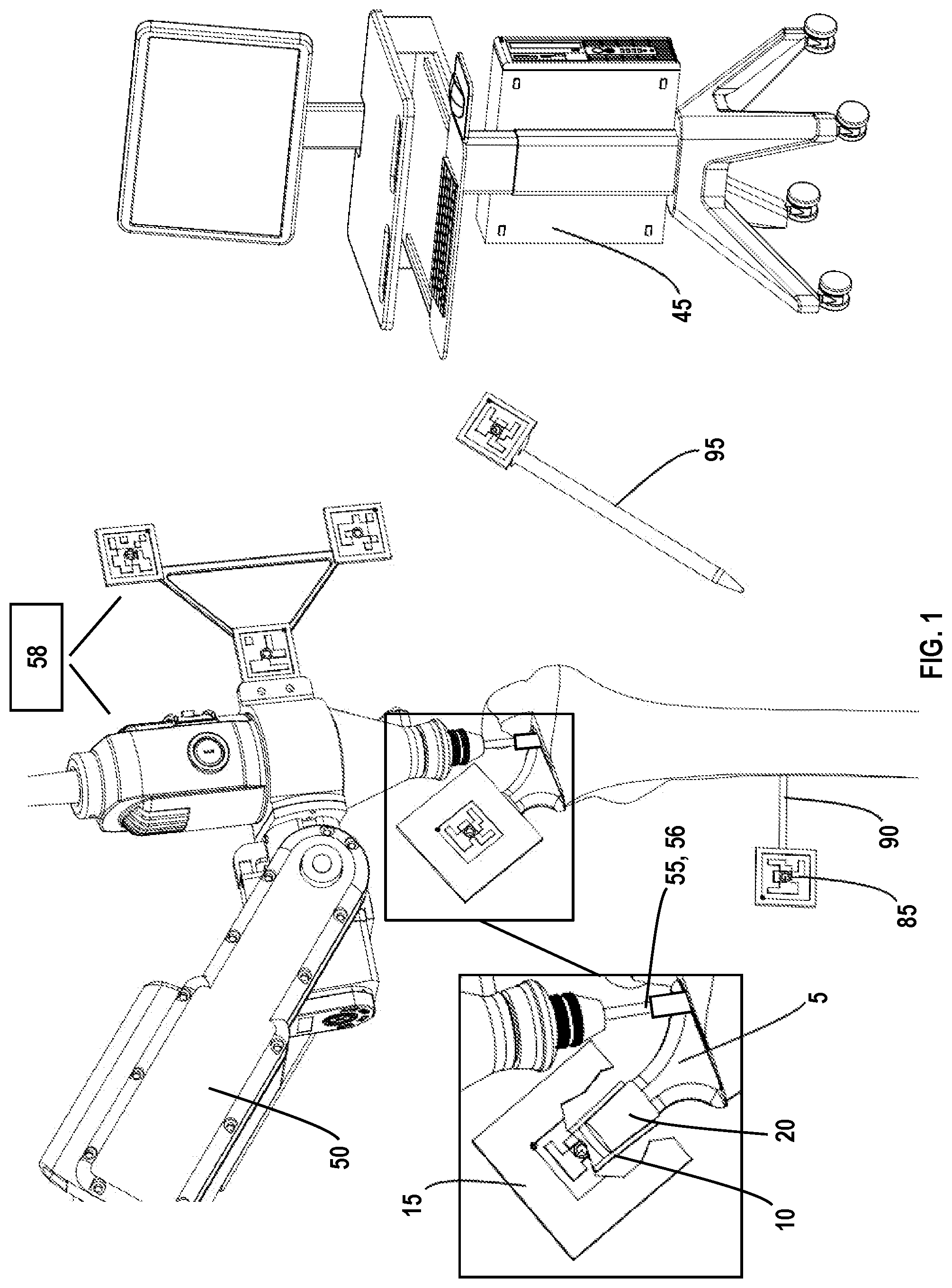 Patent US12318310 Figure 1 – Joint implant extraction and placement system and localization device used therewith