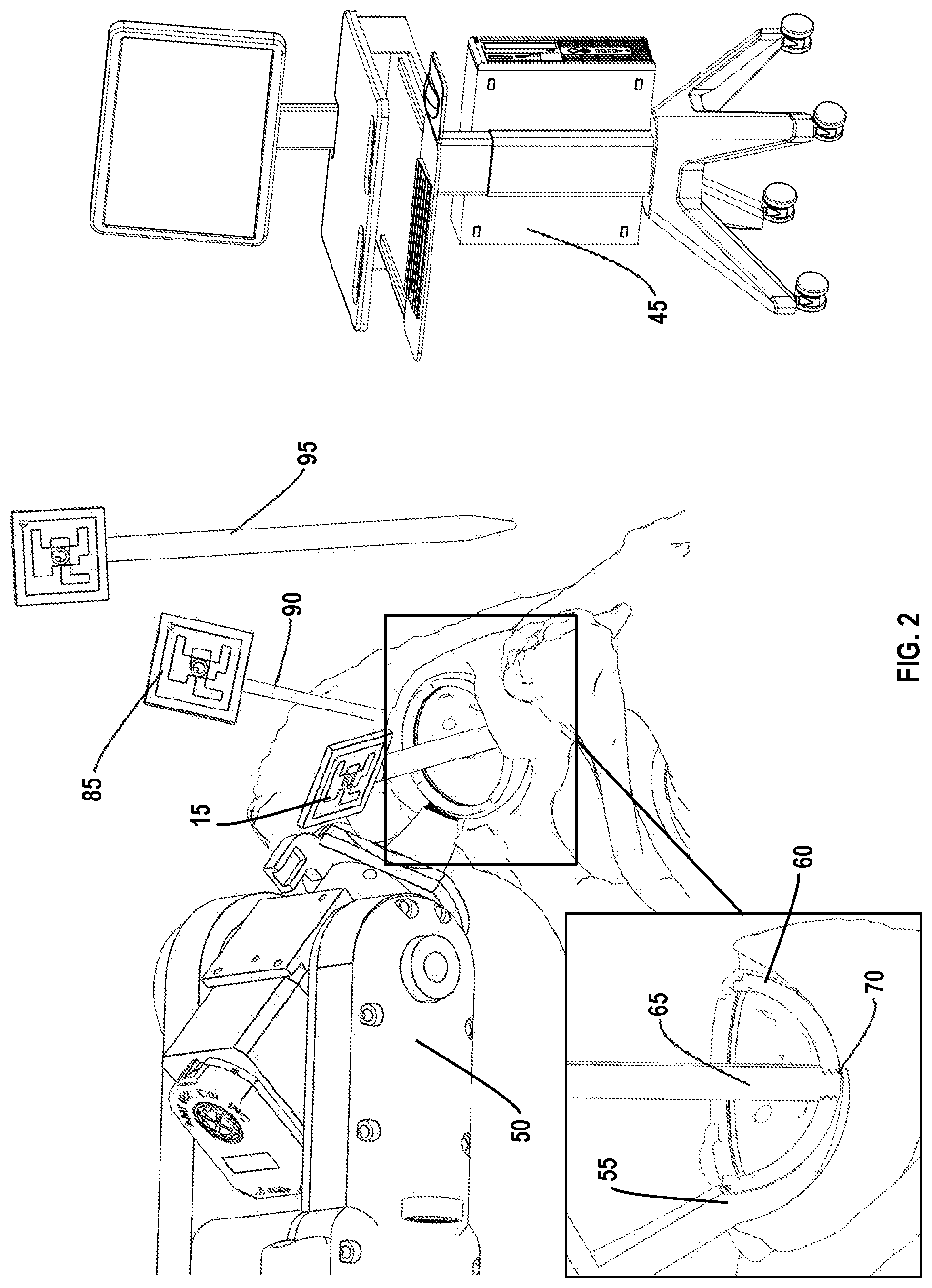Patent US12318310 Figure 2 – Joint implant extraction and placement system and localization device used therewith