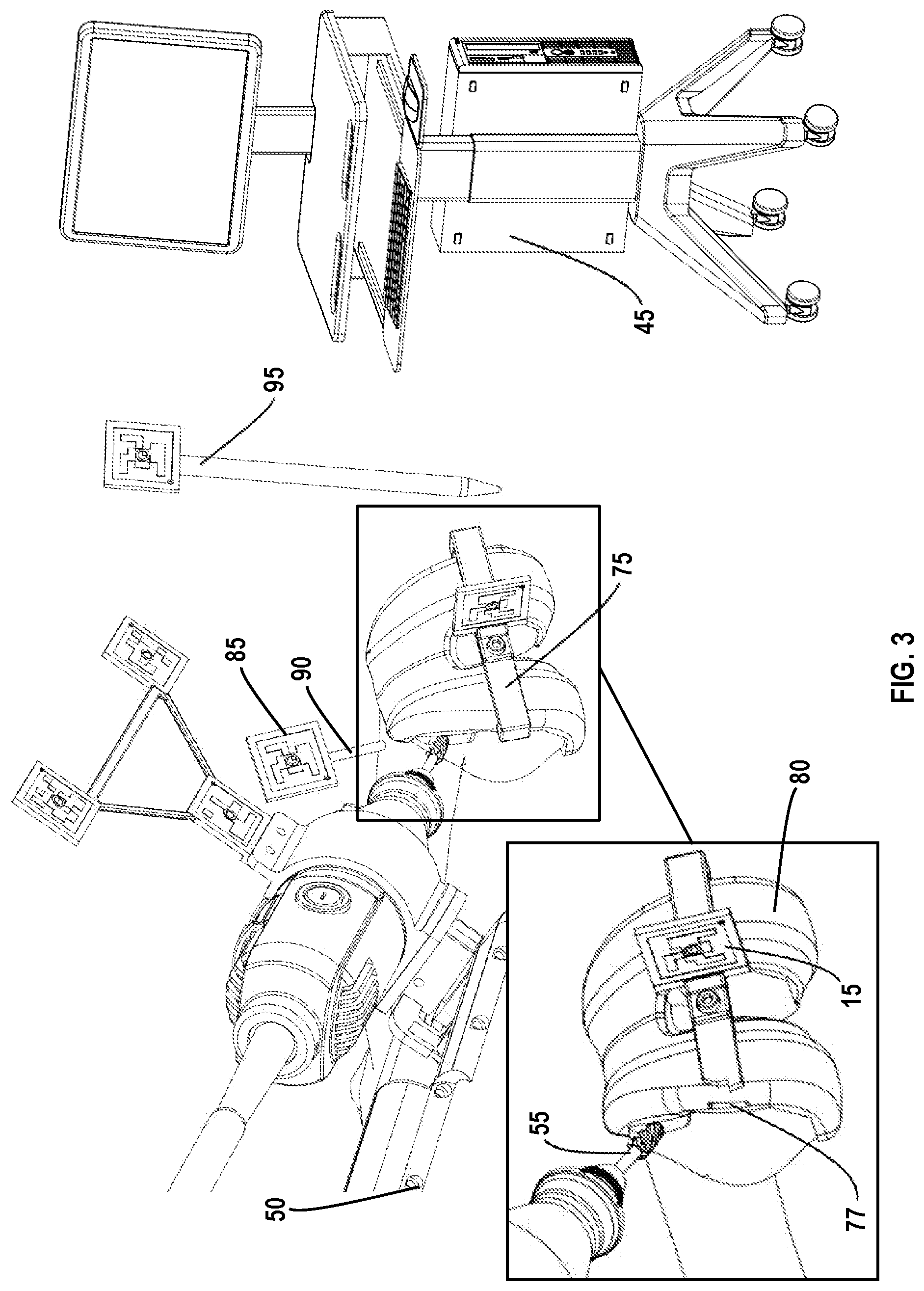 Patent US12318310 Figure 3 – Joint implant extraction and placement system and localization device used therewith