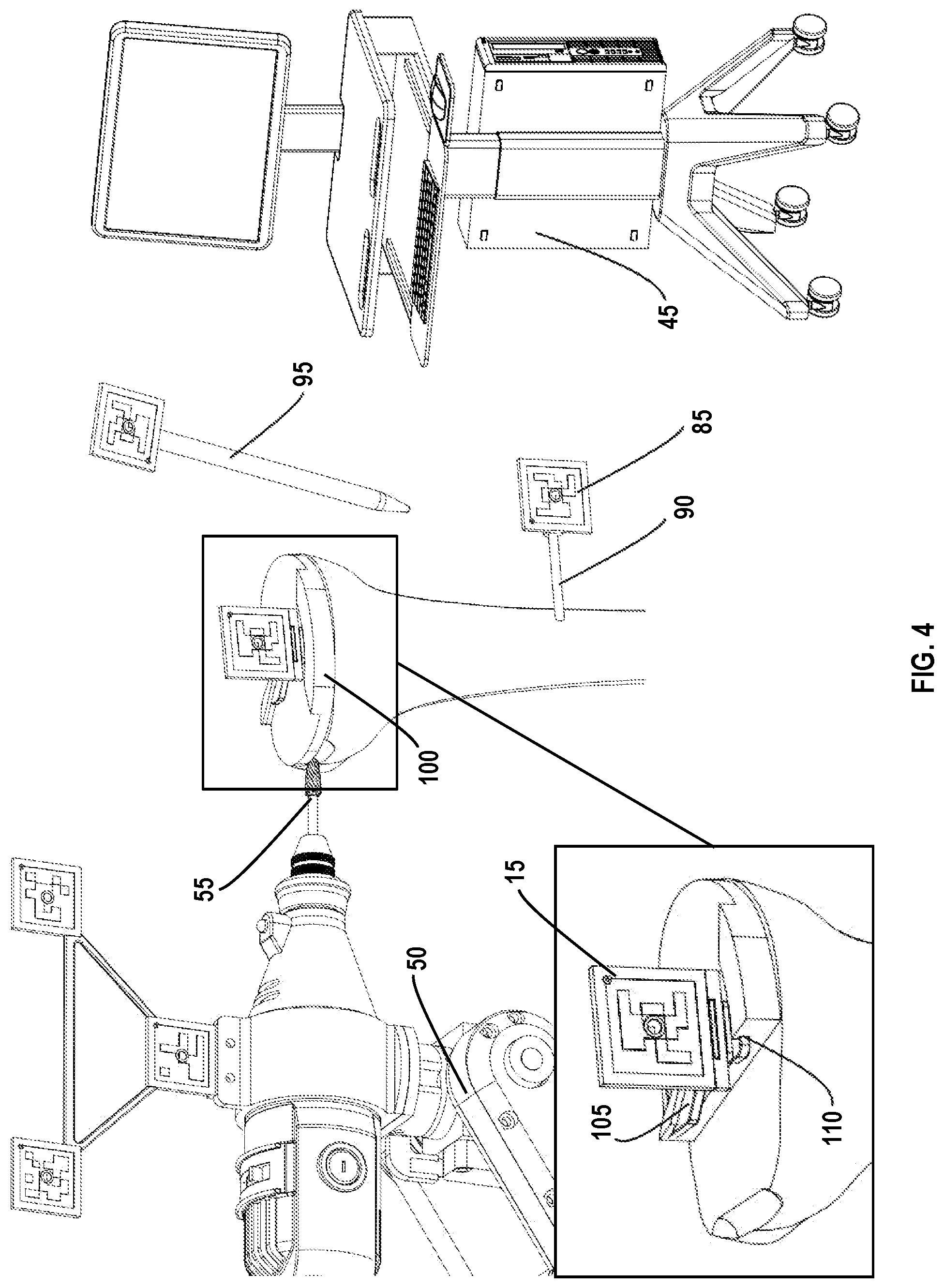 Patent US12318310 Figure 4 – Joint implant extraction and placement system and localization device used therewith