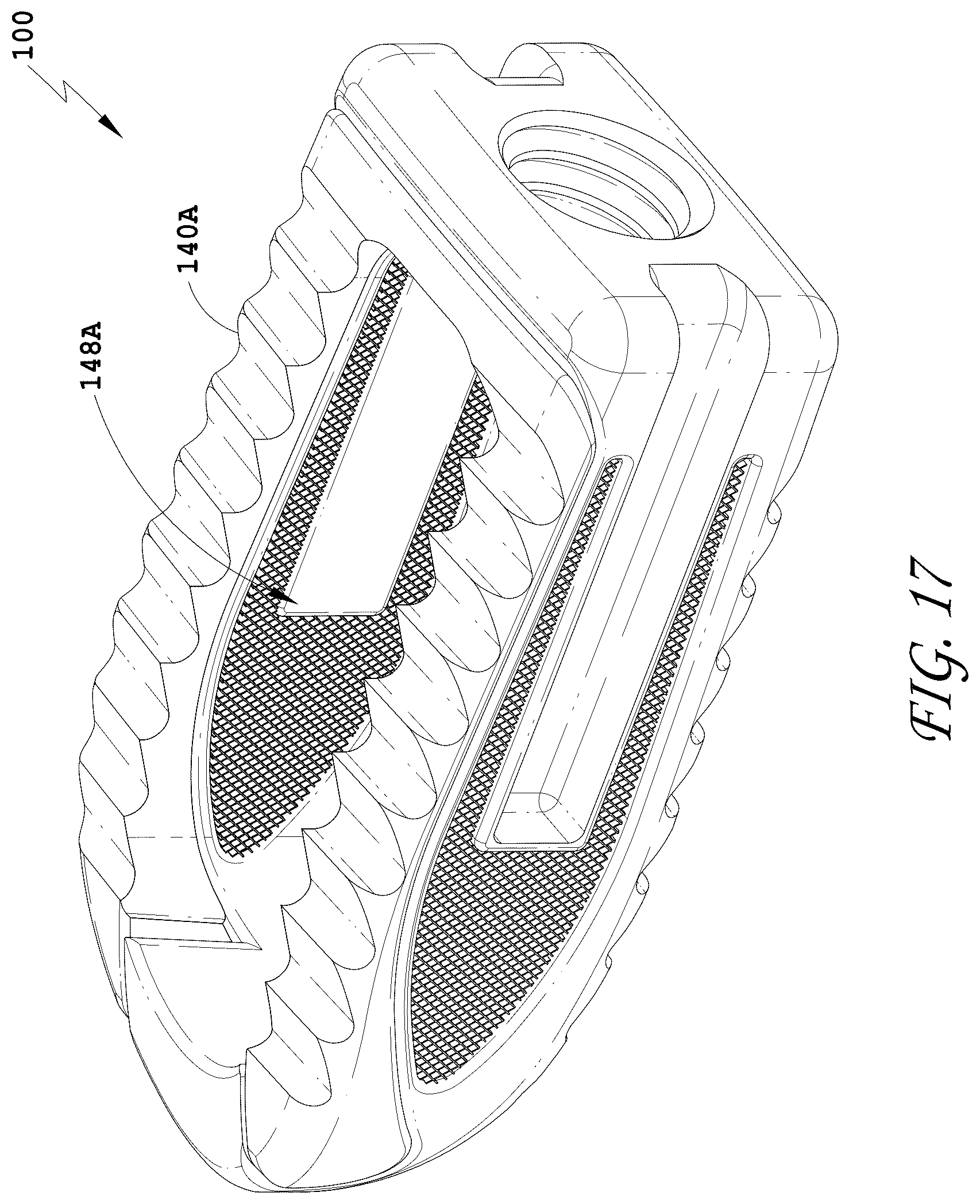 Patent US12318311 Figure 14 – Spinal implant device