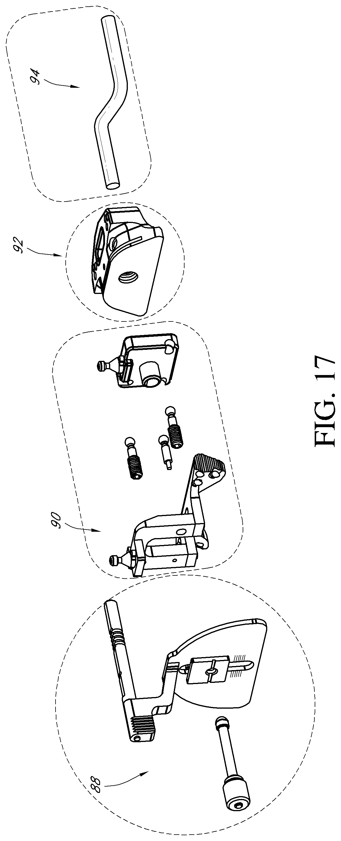 Patent US12318313 Figure 18 – Systems and methods for joint replacement
