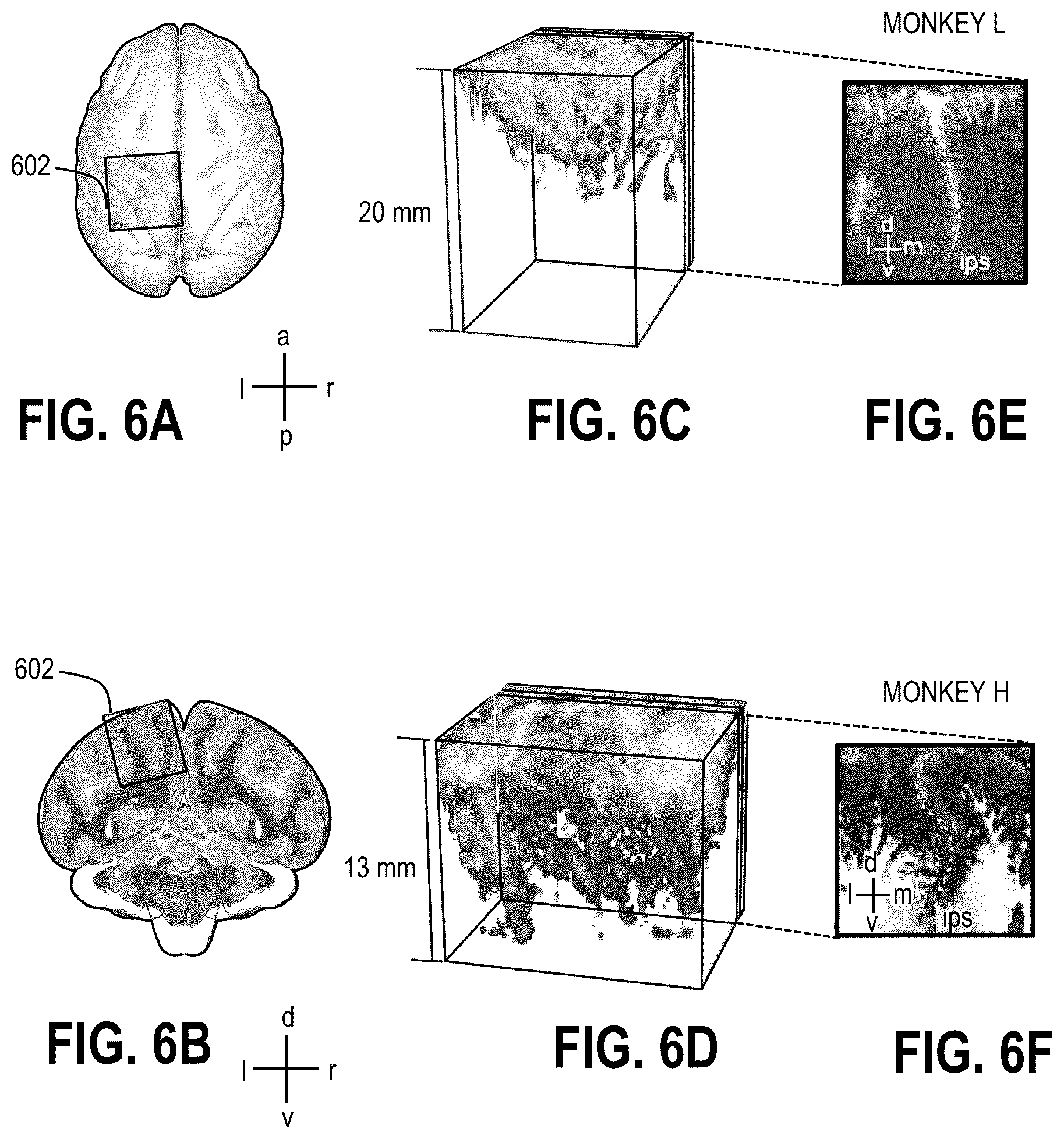 Patent US12318315 Figure 7 – Decoding movement intention using ultrasound neuroimaging
