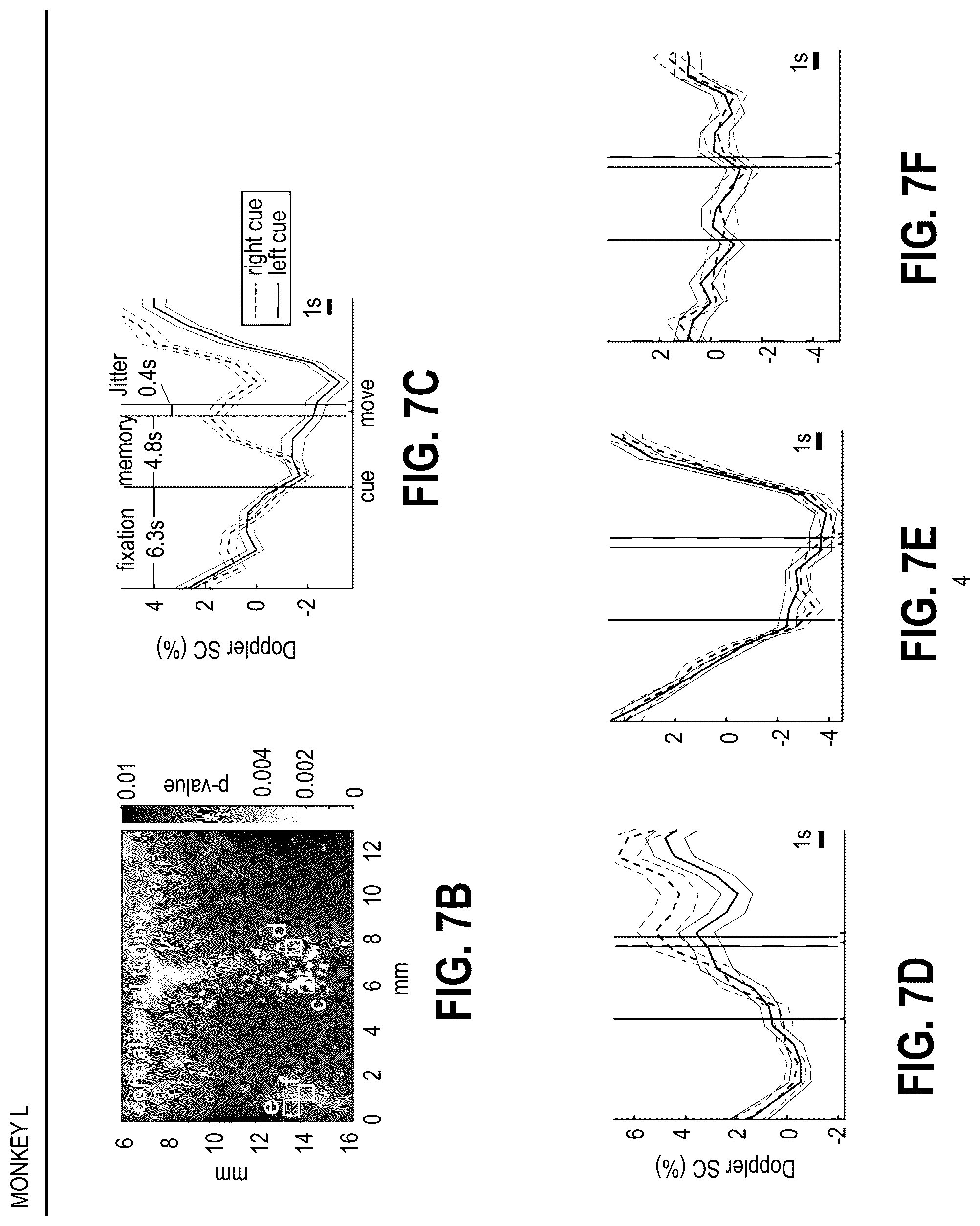 Patent US12318315 Figure 9 – Decoding movement intention using ultrasound neuroimaging
