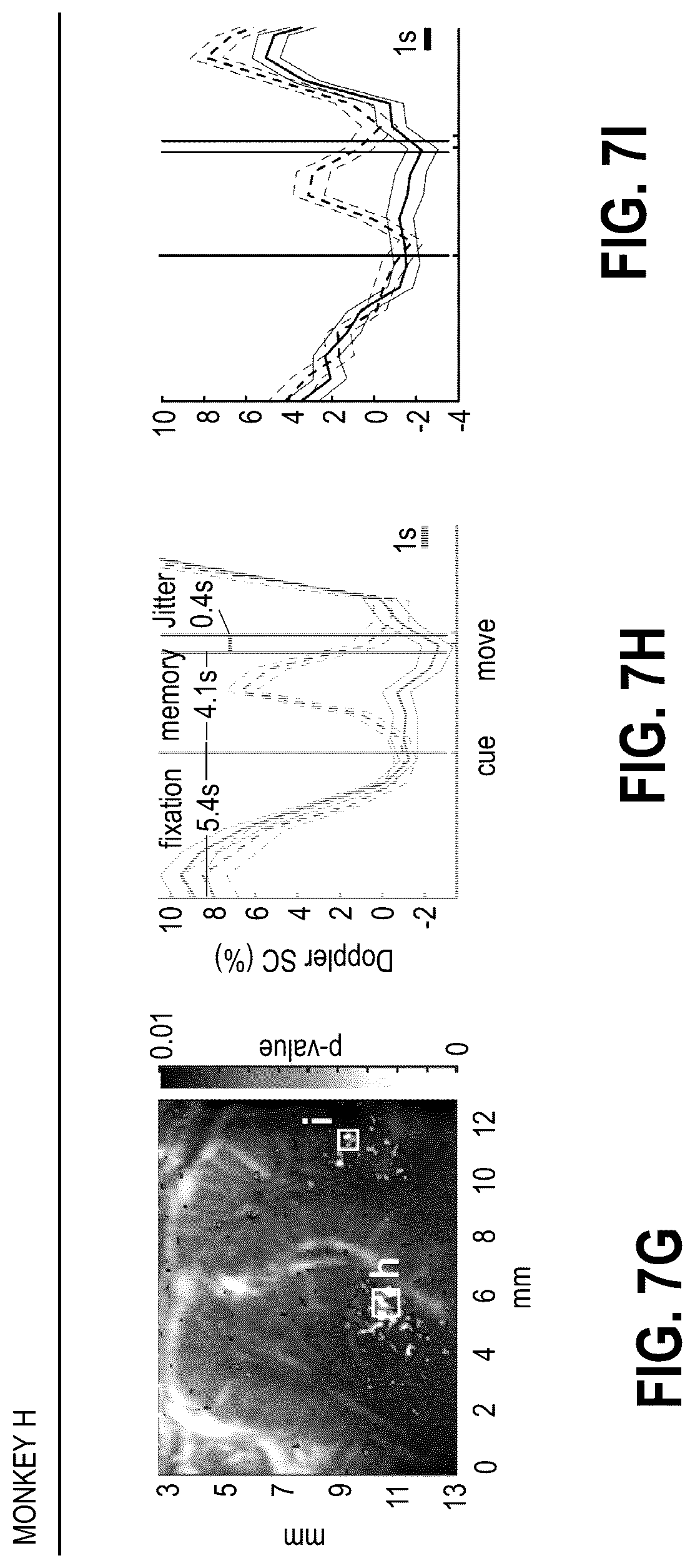 Patent US12318315 Figure 10 – Decoding movement intention using ultrasound neuroimaging