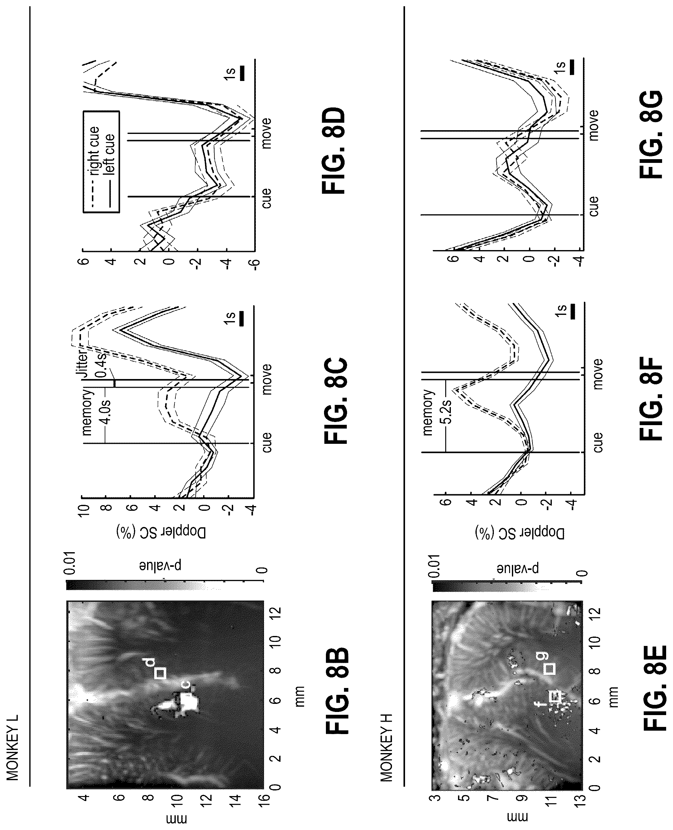 Patent US12318315 Figure 12 – Decoding movement intention using ultrasound neuroimaging