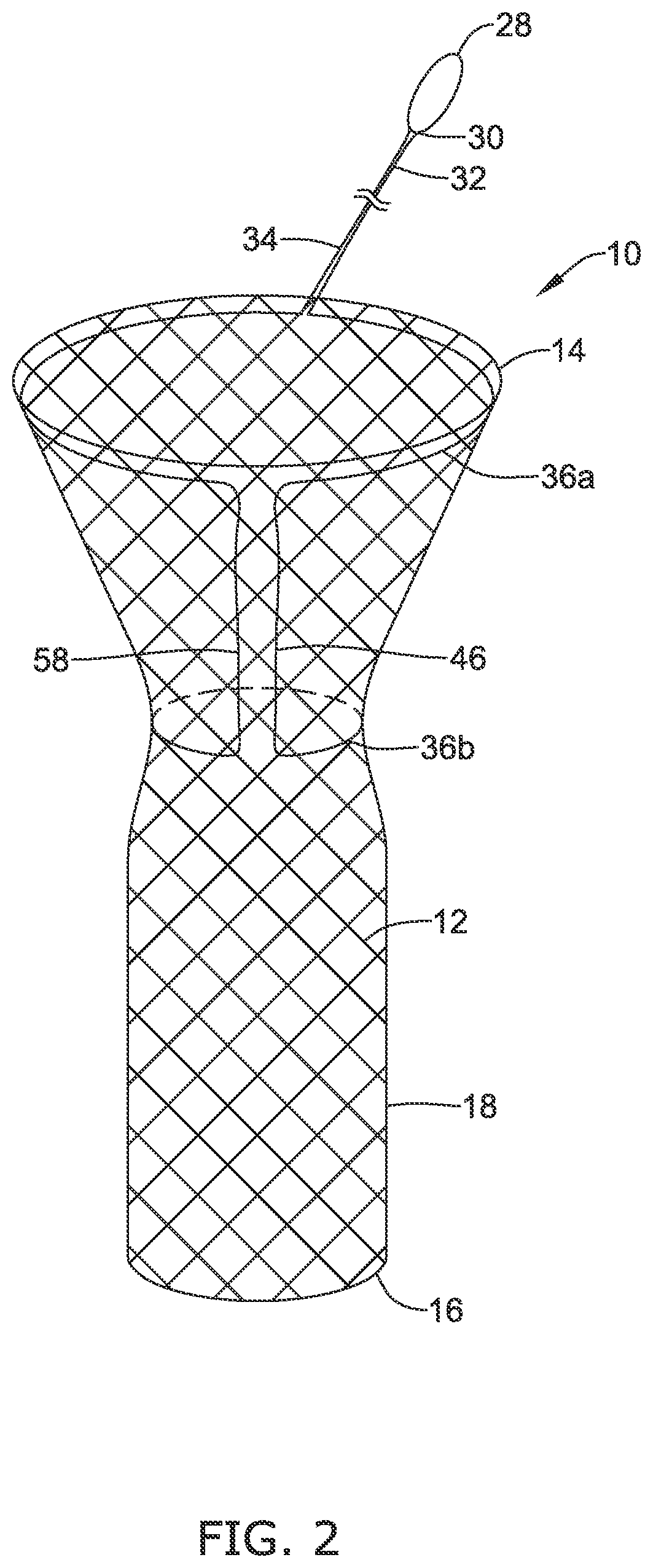 Patent US12318316 Figure 2 – Repositionable and removable stents