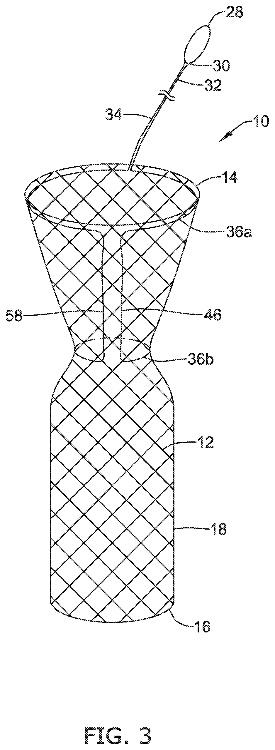 Patent US12318316 Figure 3 – Repositionable and removable stents