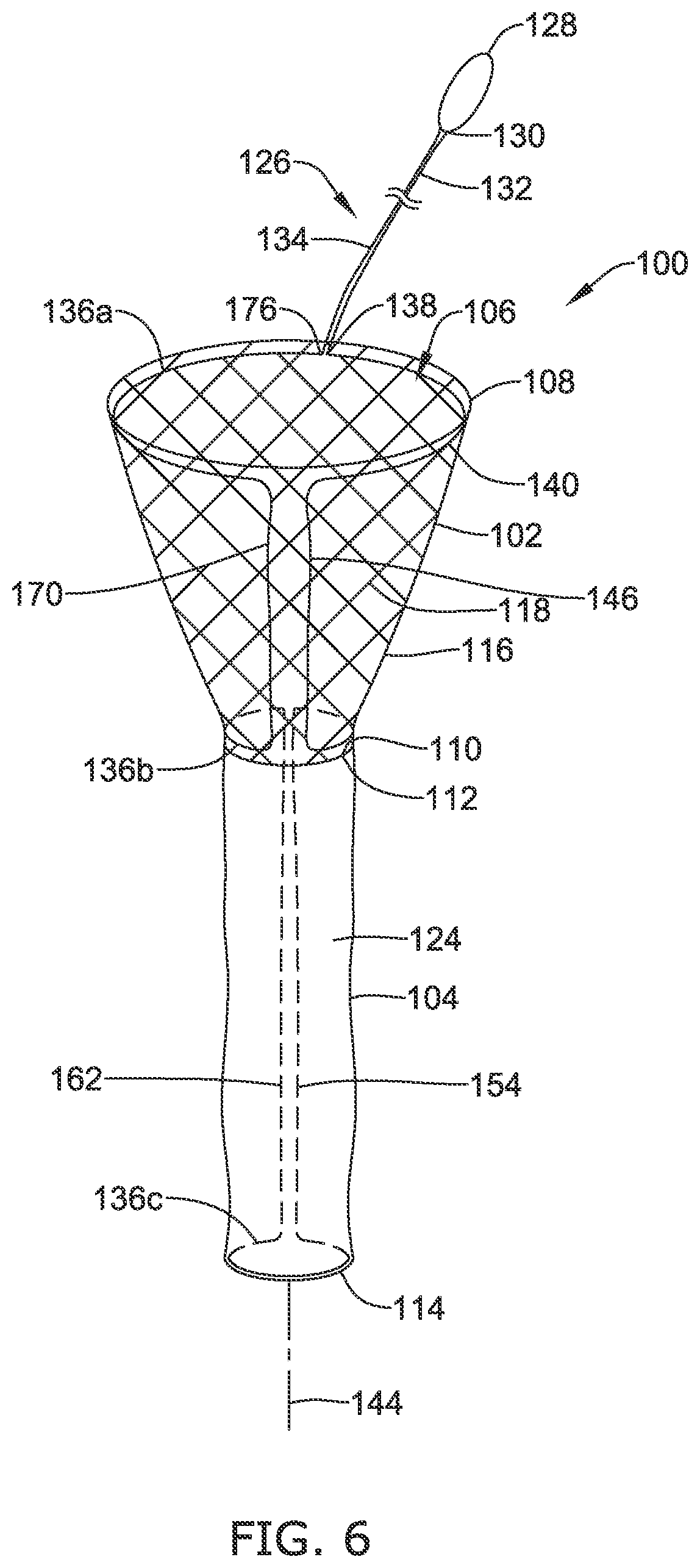 Patent US12318316 Figure 6 – Repositionable and removable stents