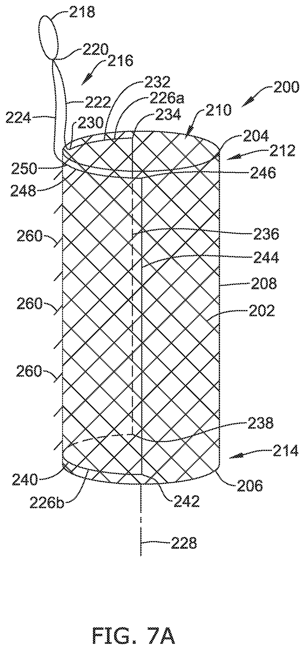 Patent US12318316 Figure 7 – Repositionable and removable stents
