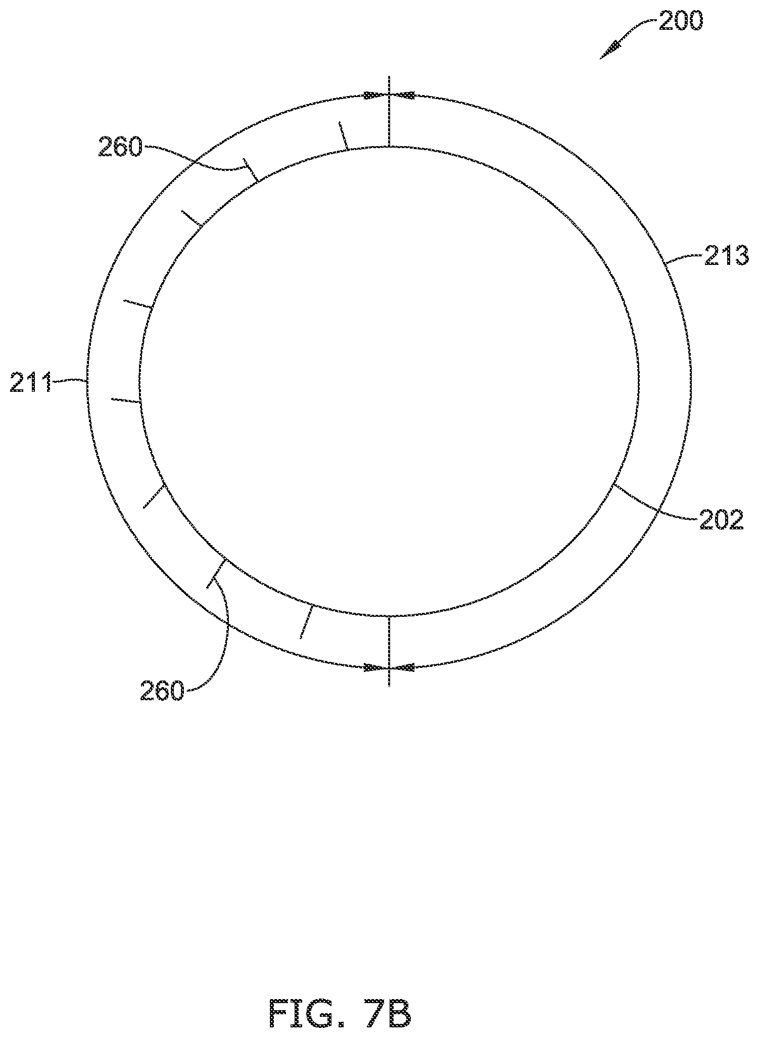 Patent US12318316 Figure 8 – Repositionable and removable stents