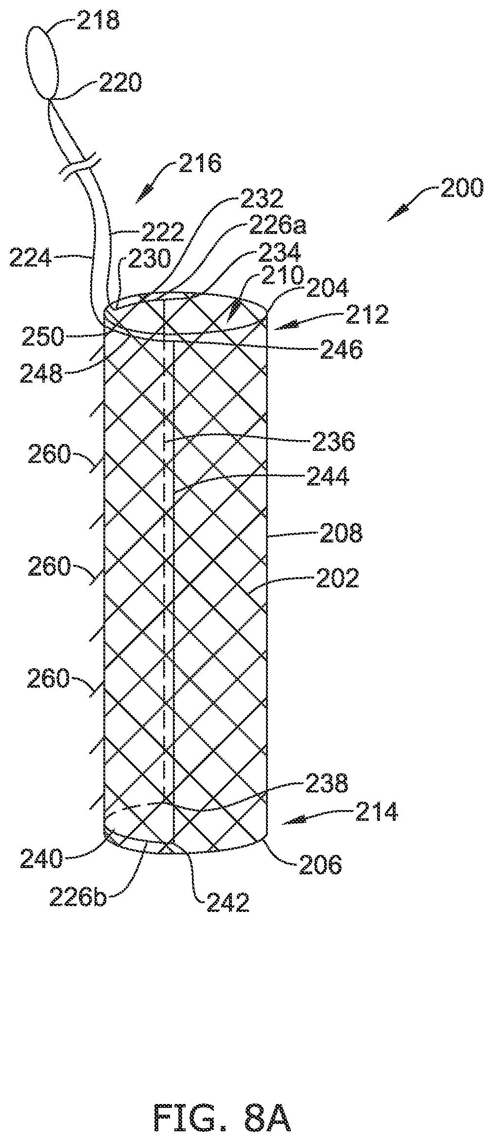 Patent US12318316 Figure 9 – Repositionable and removable stents