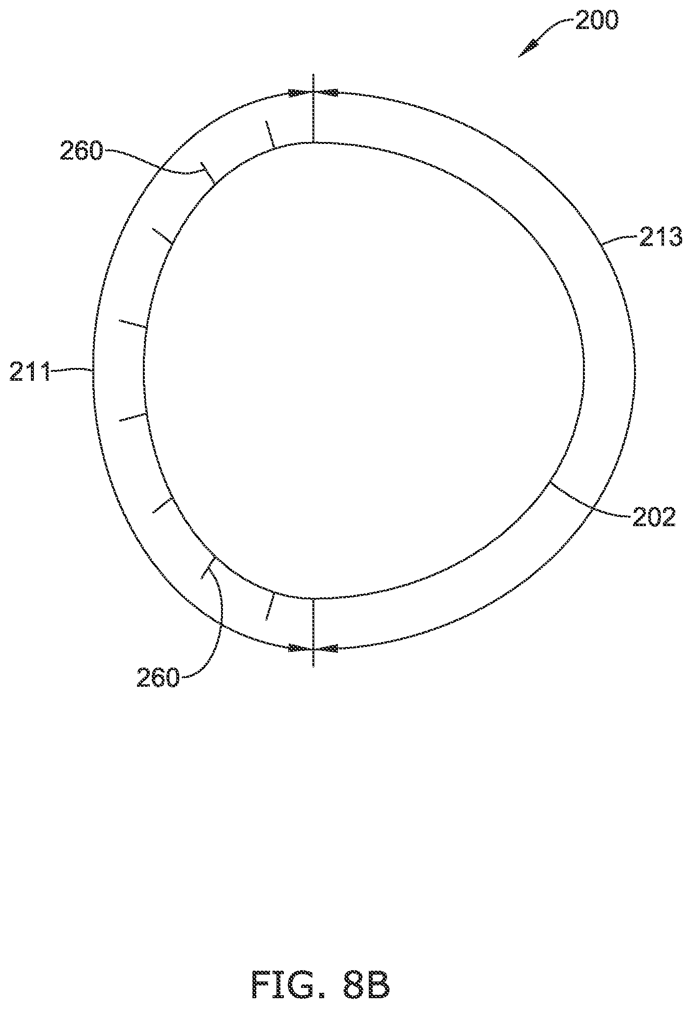 Patent US12318316 Figure 10 – Repositionable and removable stents