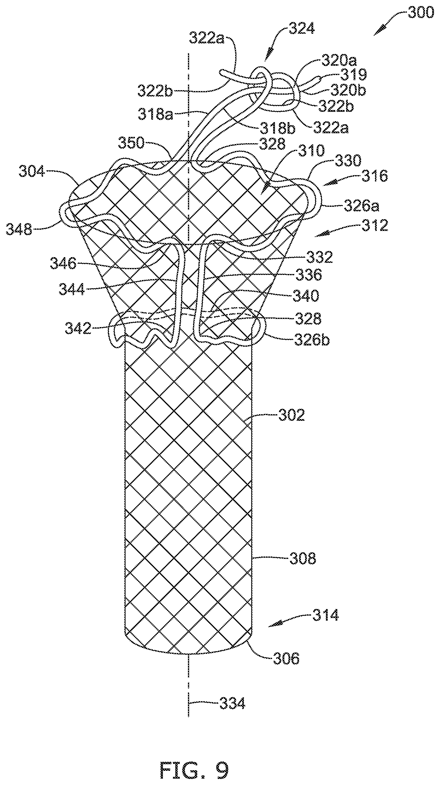 Patent US12318316 Figure 11 – Repositionable and removable stents