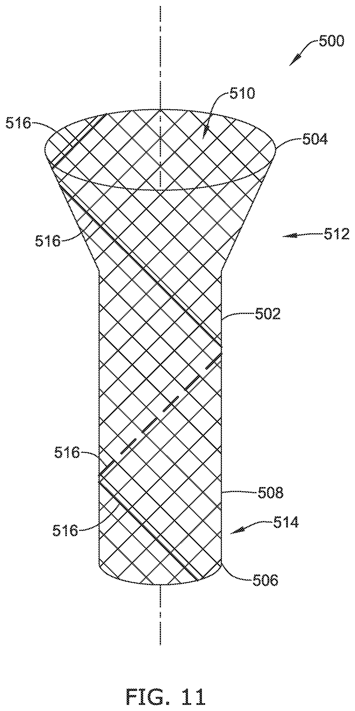 Patent US12318316 Figure 13 – Repositionable and removable stents