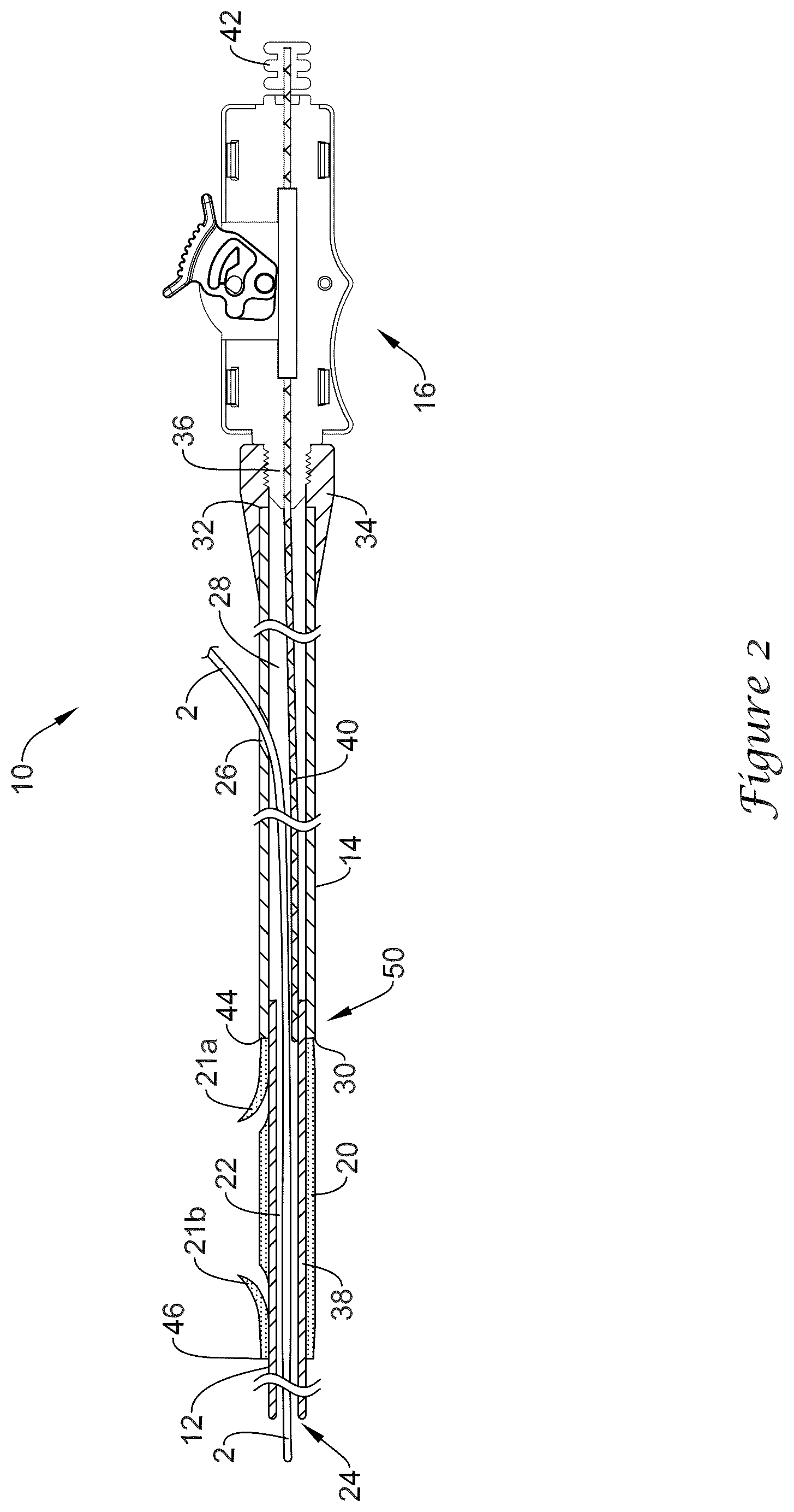 Patent US12318317 Figure 2 – Stent delivery system having retention structure