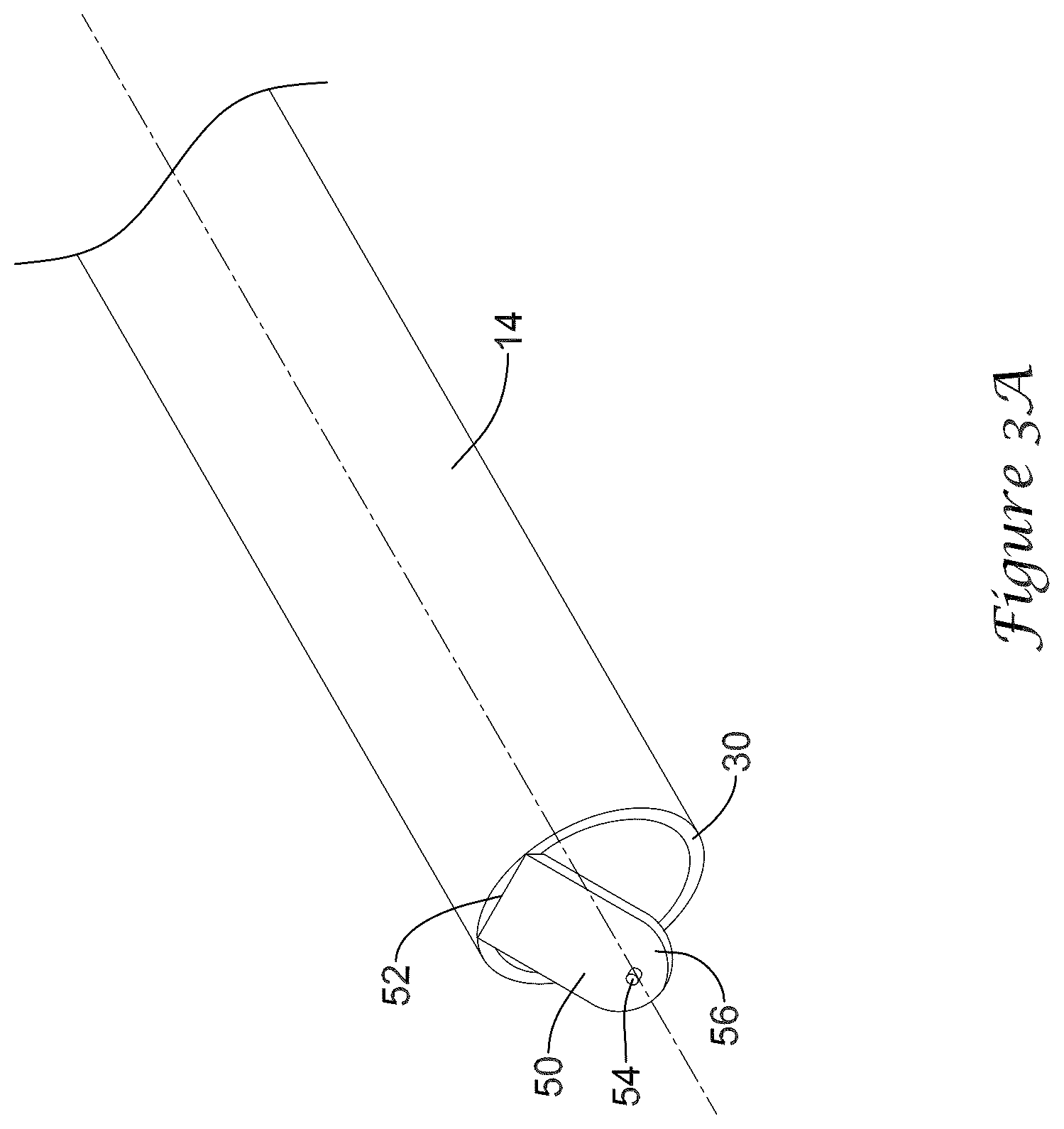 Patent US12318317 Figure 3 – Stent delivery system having retention structure