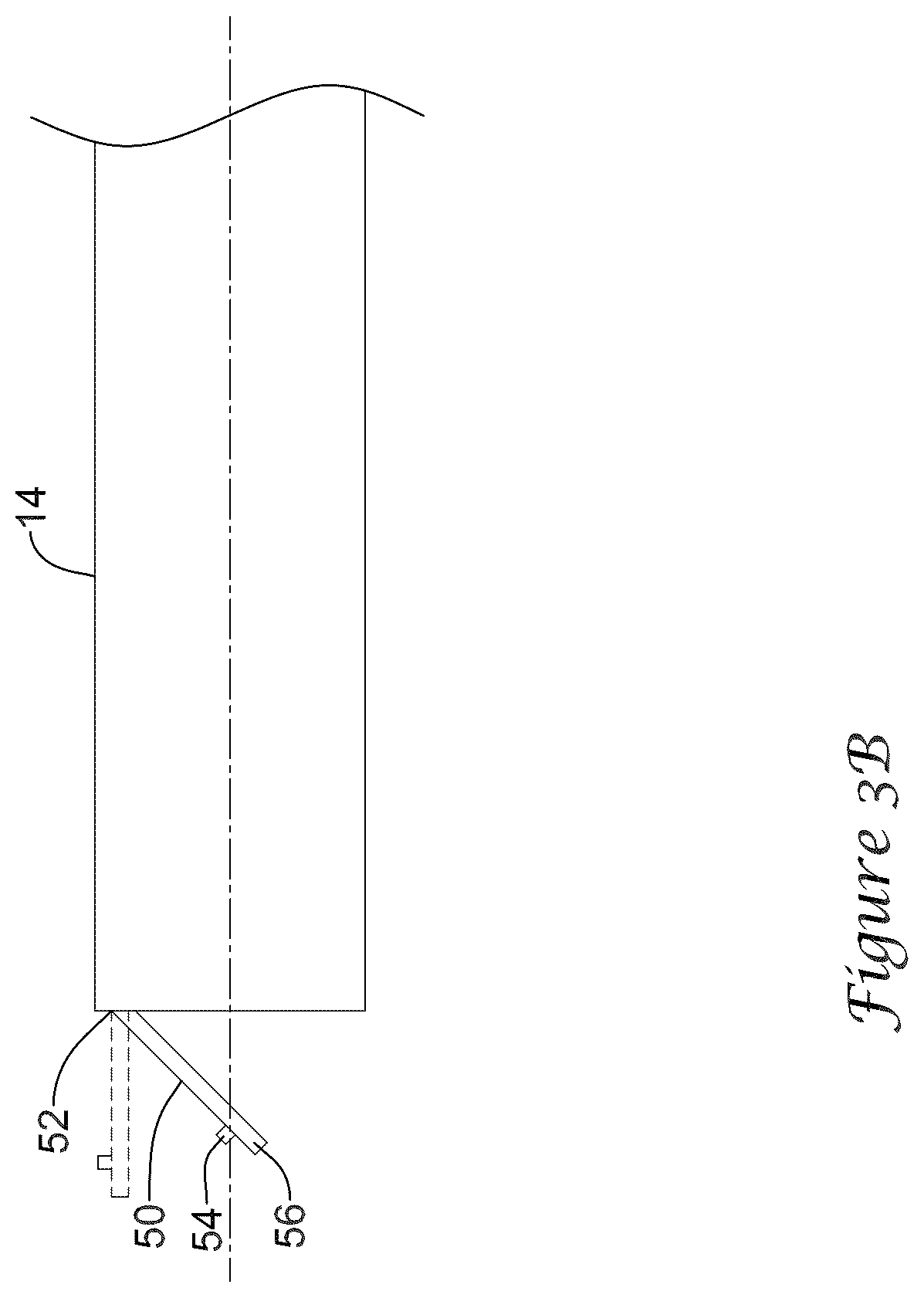 Patent US12318317 Figure 4 – Stent delivery system having retention structure
