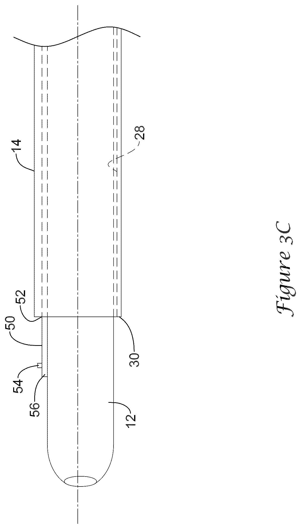 Patent US12318317 Figure 5 – Stent delivery system having retention structure