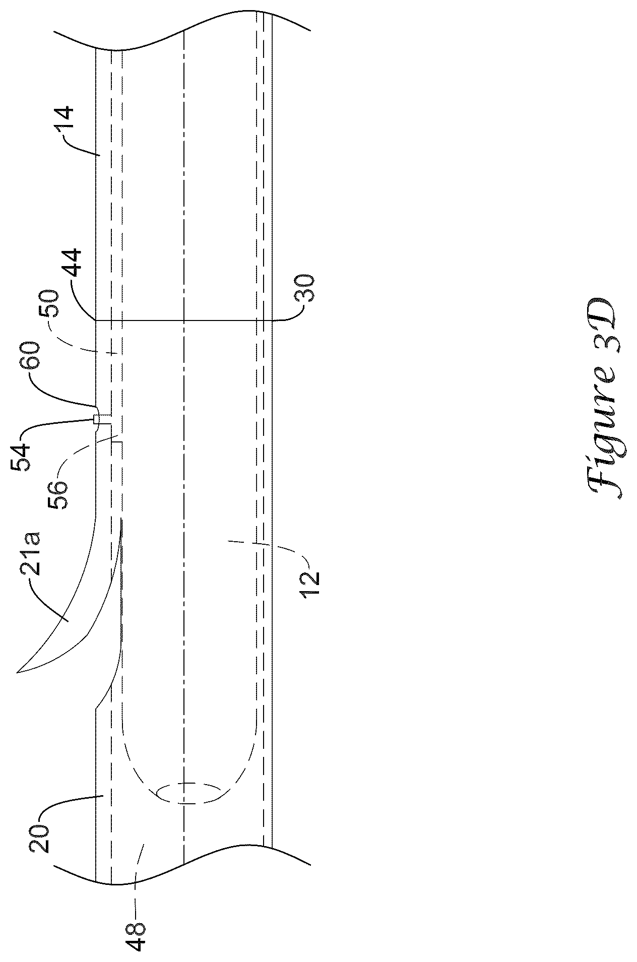 Patent US12318317 Figure 6 – Stent delivery system having retention structure