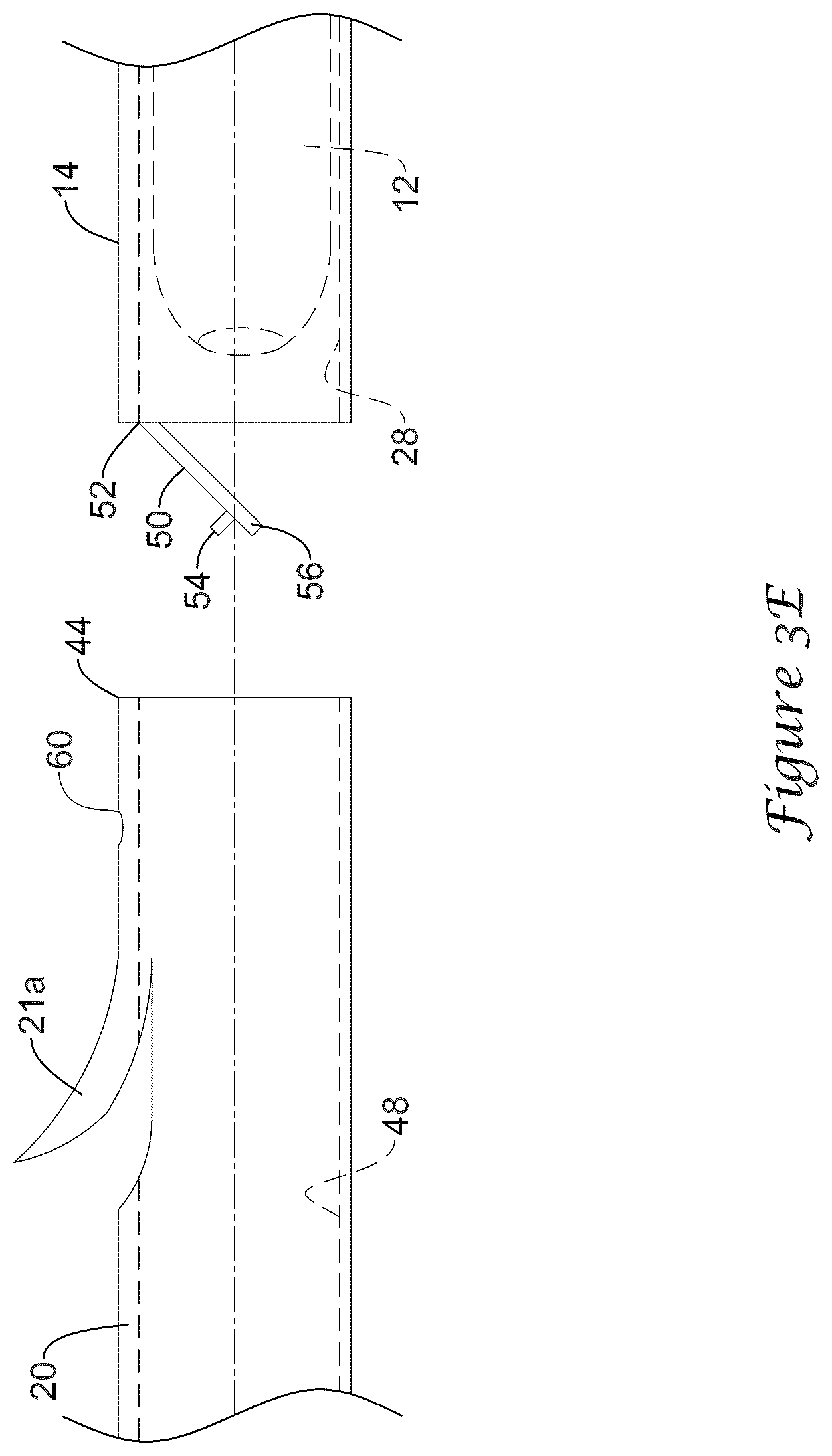 Patent US12318317 Figure 7 – Stent delivery system having retention structure
