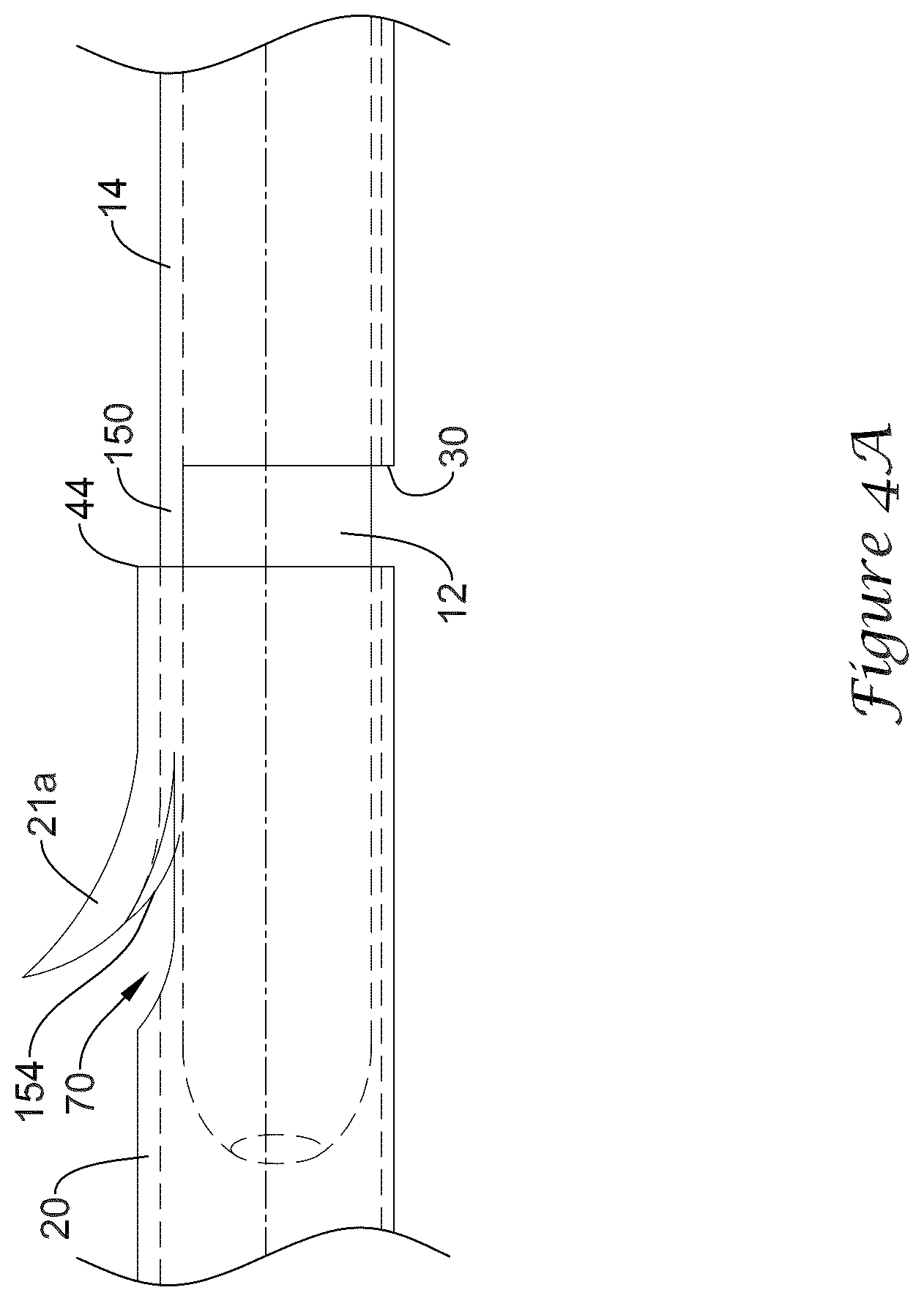 Patent US12318317 Figure 8 – Stent delivery system having retention structure