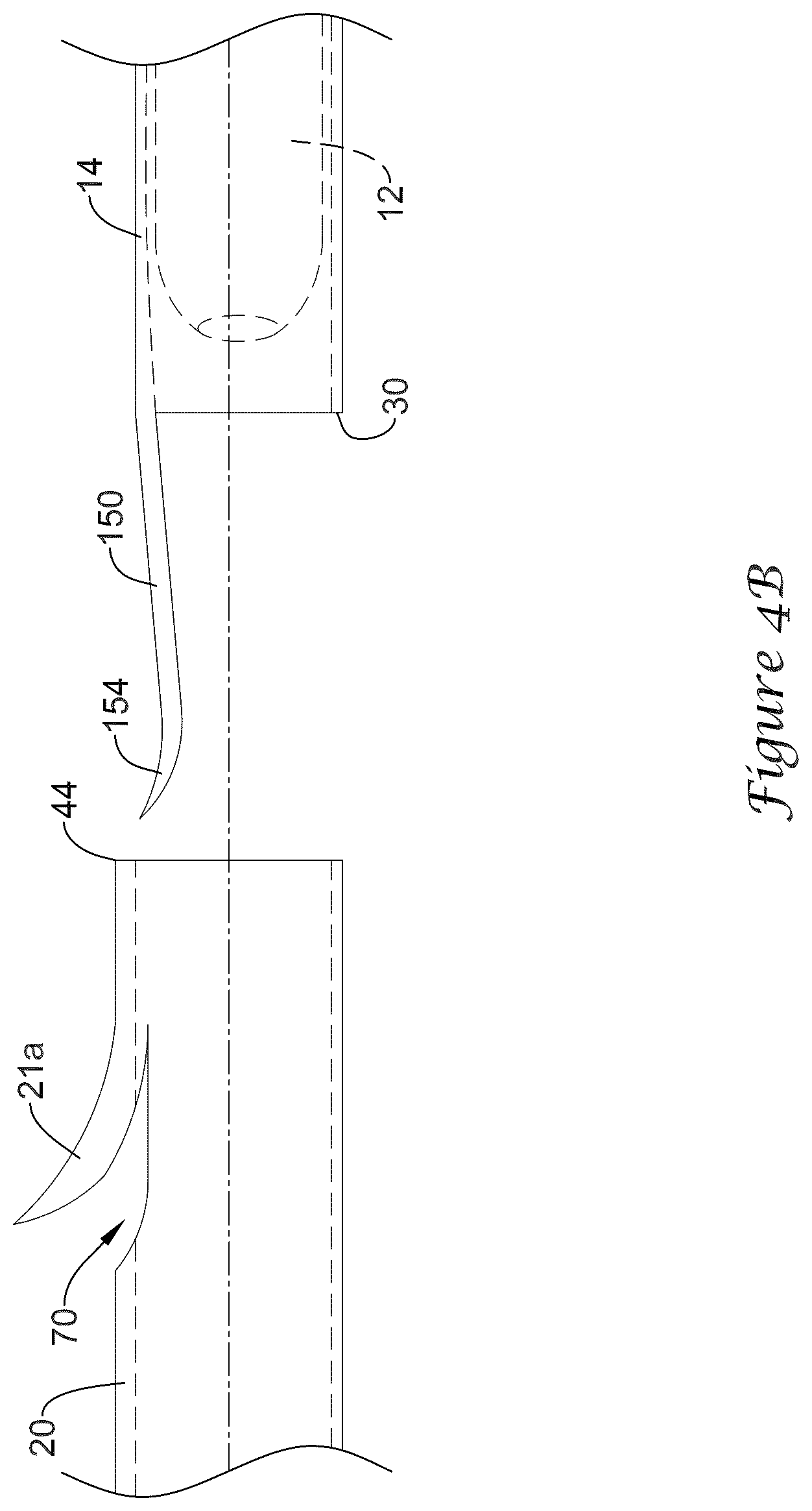 Patent US12318317 Figure 9 – Stent delivery system having retention structure