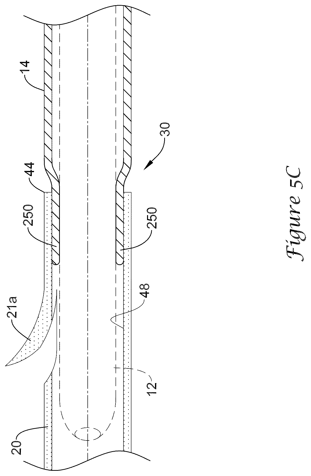 Patent US12318317 Figure 12 – Stent delivery system having retention structure