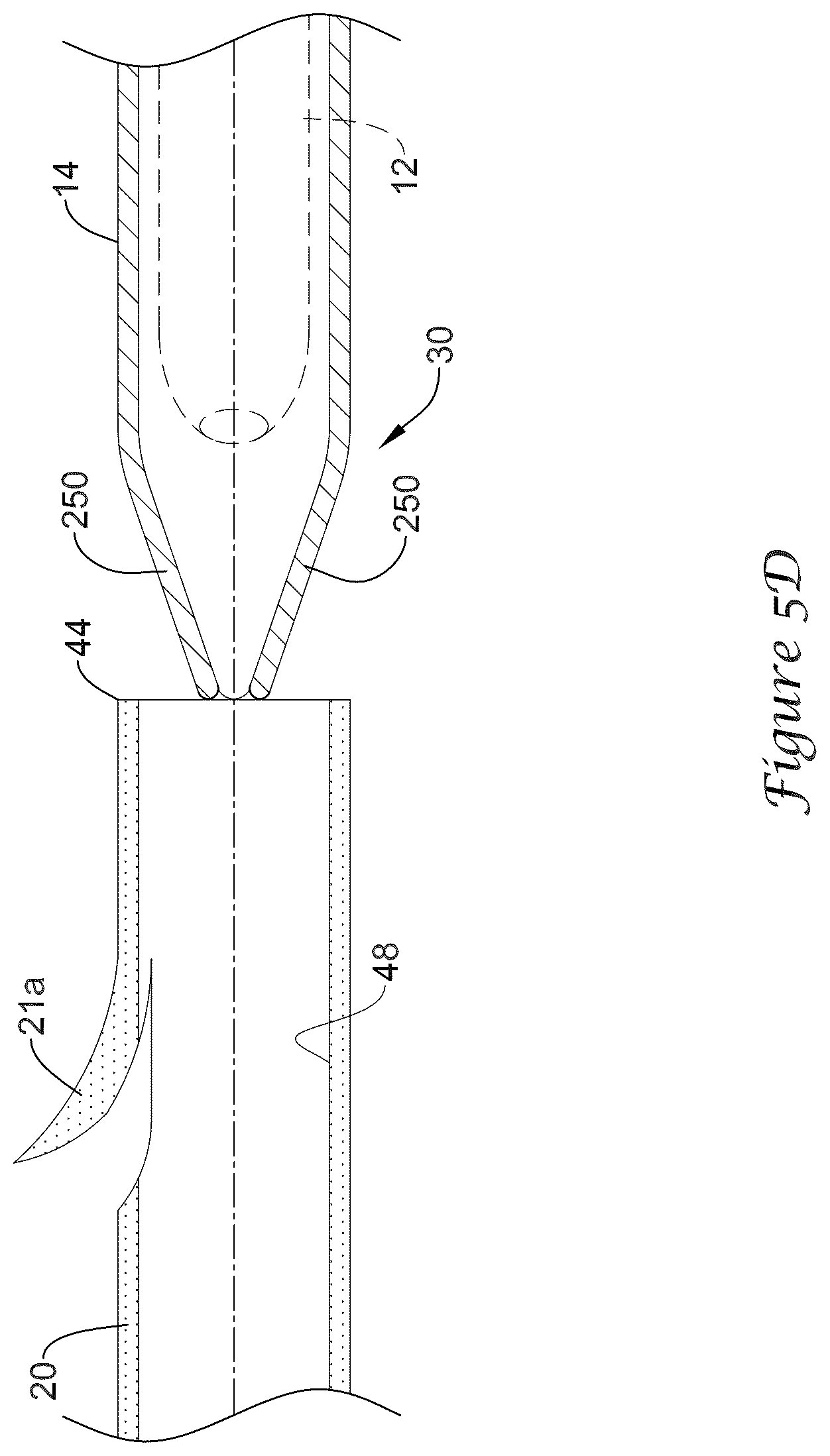Patent US12318317 Figure 13 – Stent delivery system having retention structure