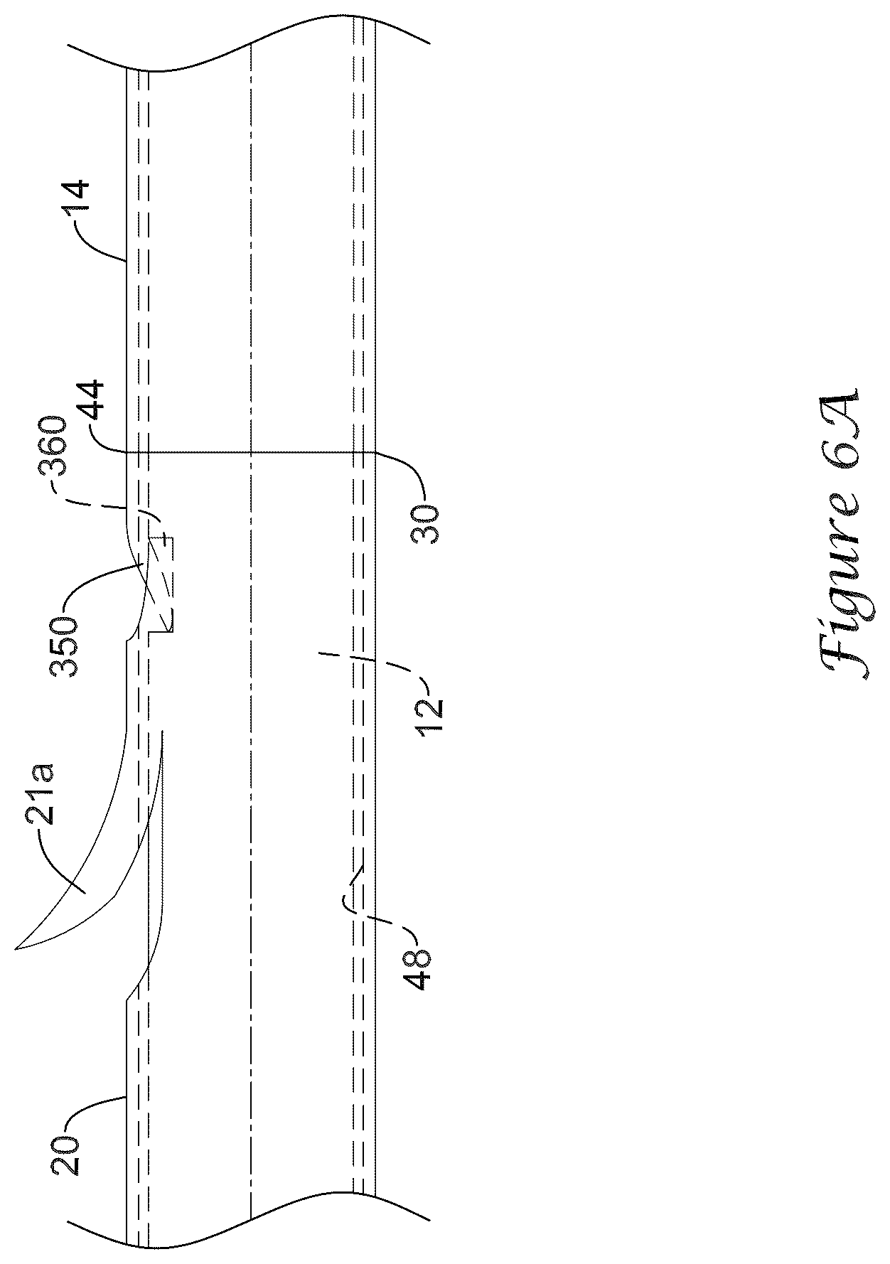 Patent US12318317 Figure 14 – Stent delivery system having retention structure