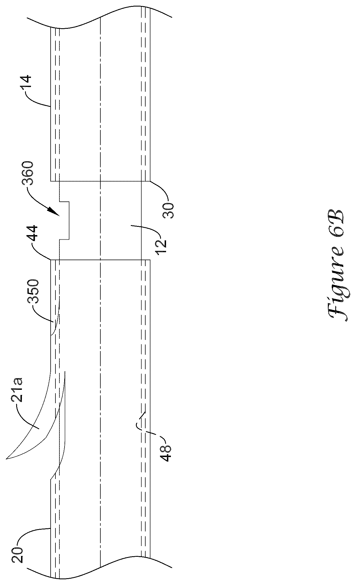 Patent US12318317 Figure 15 – Stent delivery system having retention structure