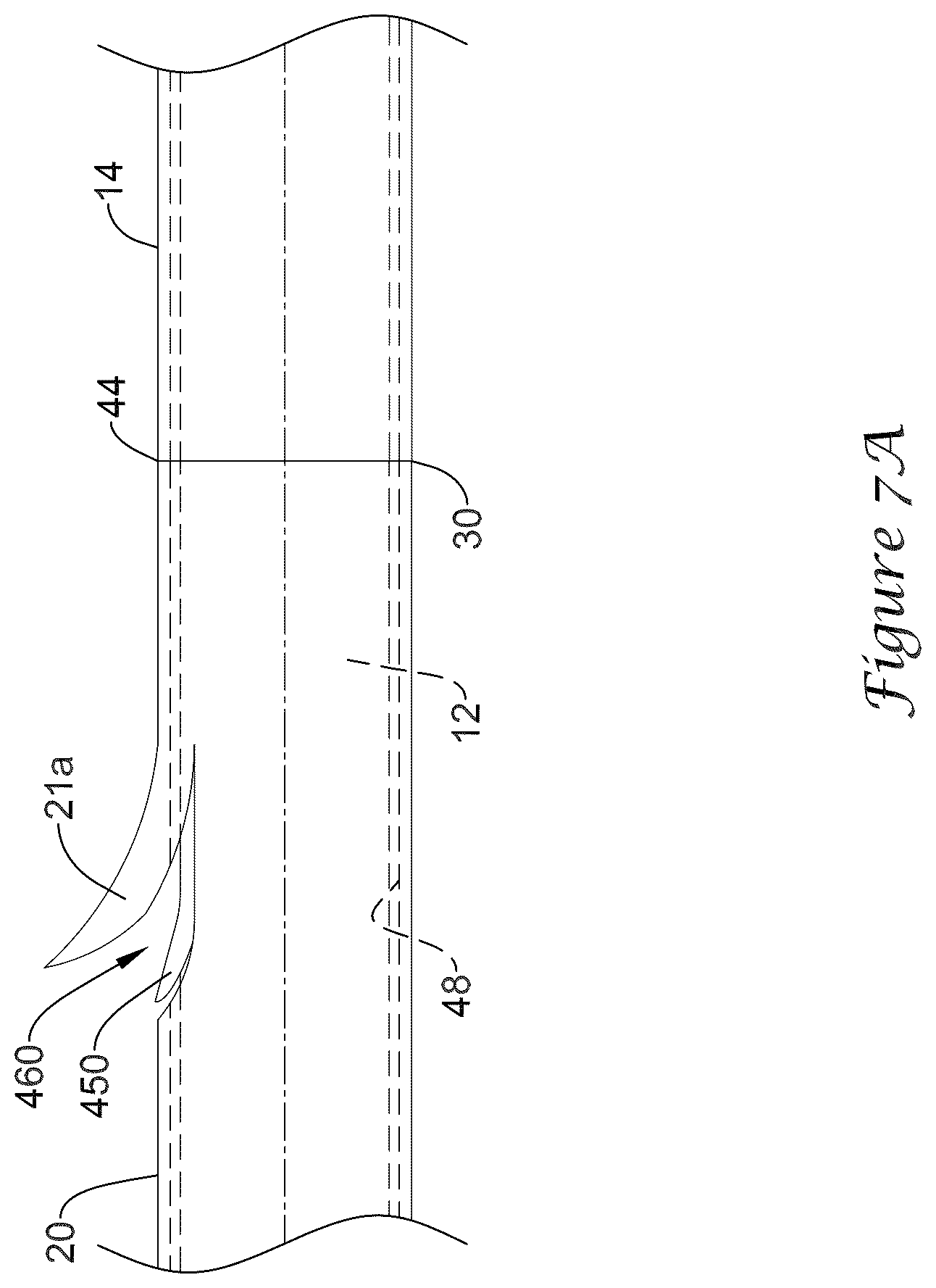 Patent US12318317 Figure 16 – Stent delivery system having retention structure