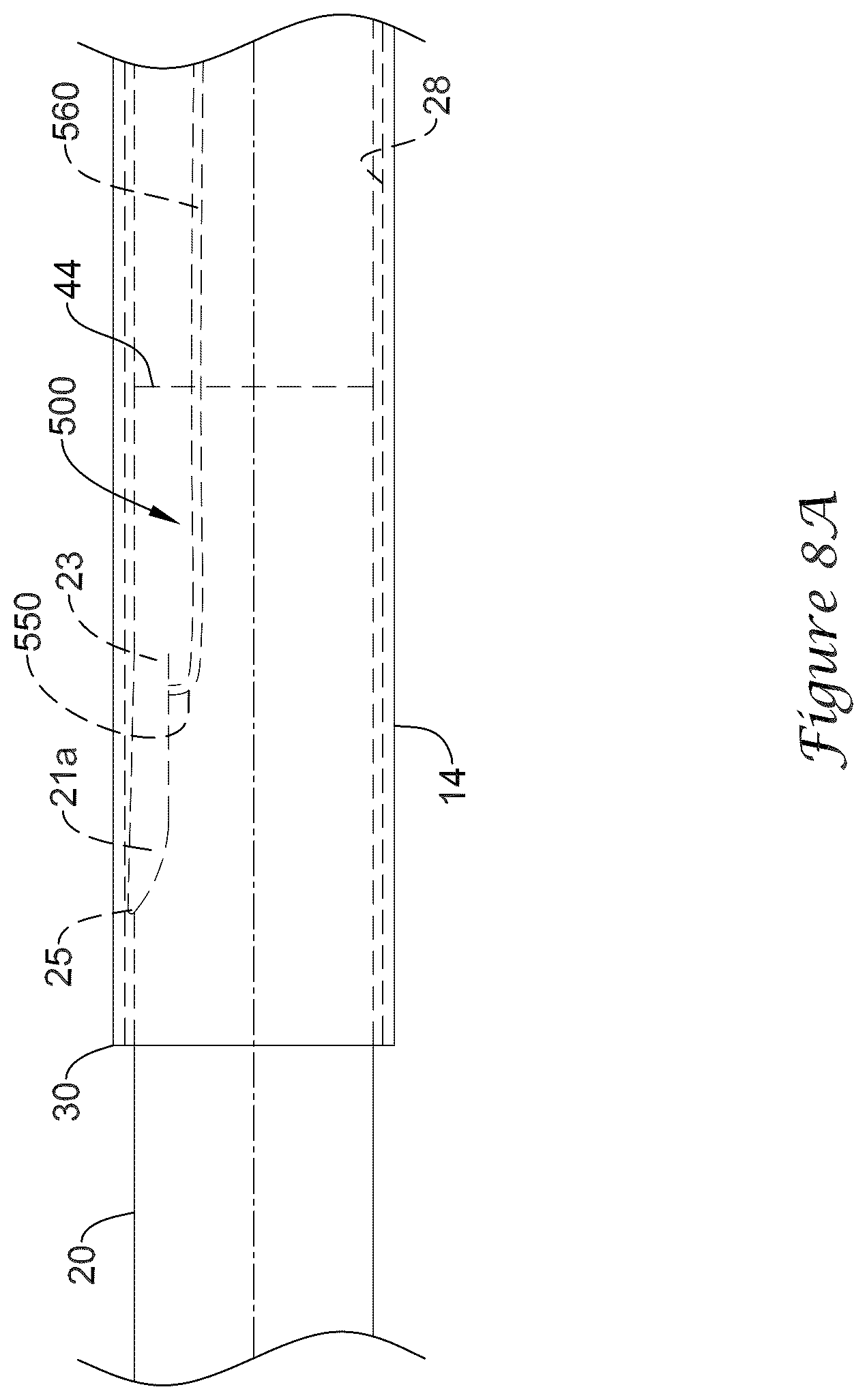 Patent US12318317 Figure 18 – Stent delivery system having retention structure