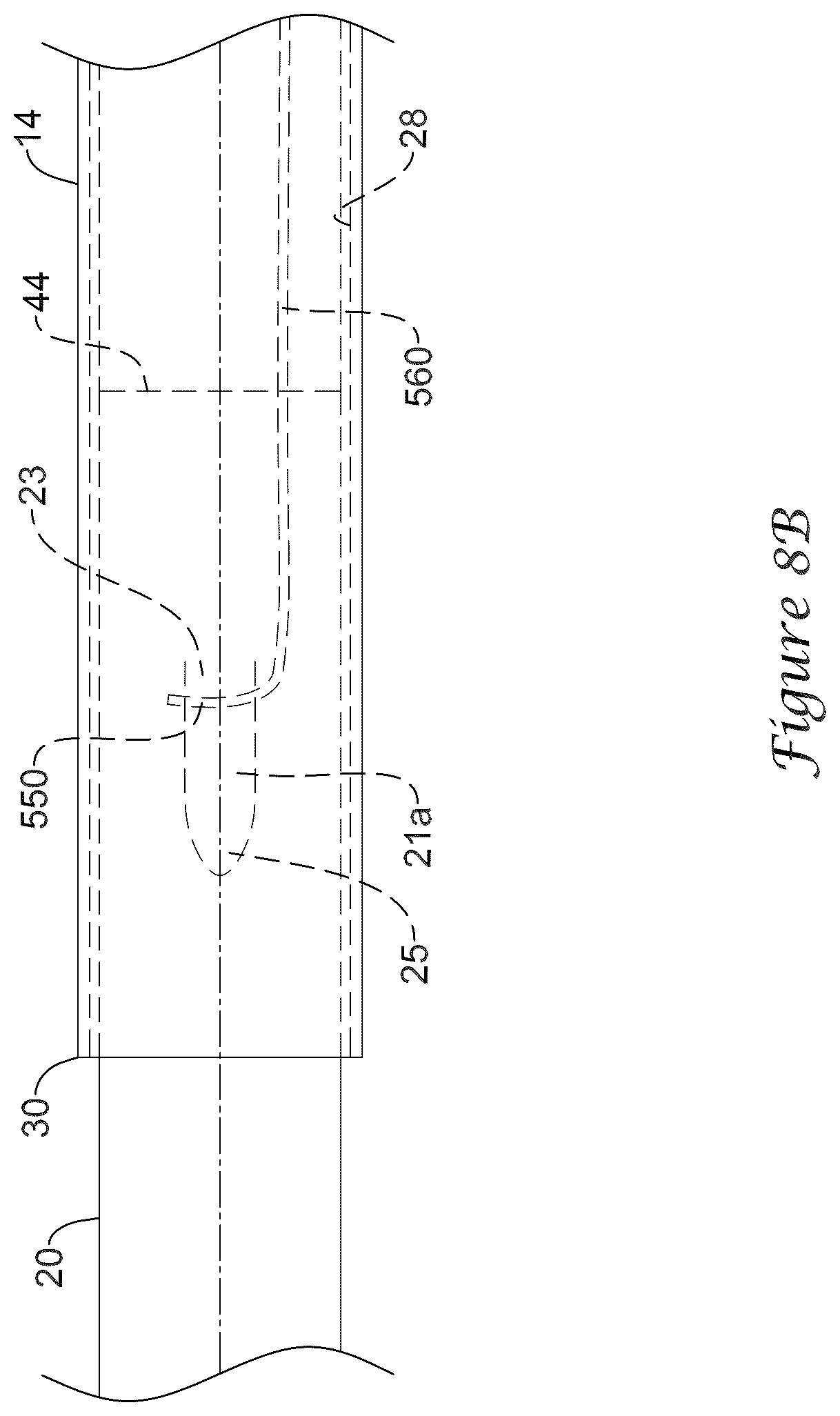 Patent US12318317 Figure 19 – Stent delivery system having retention structure