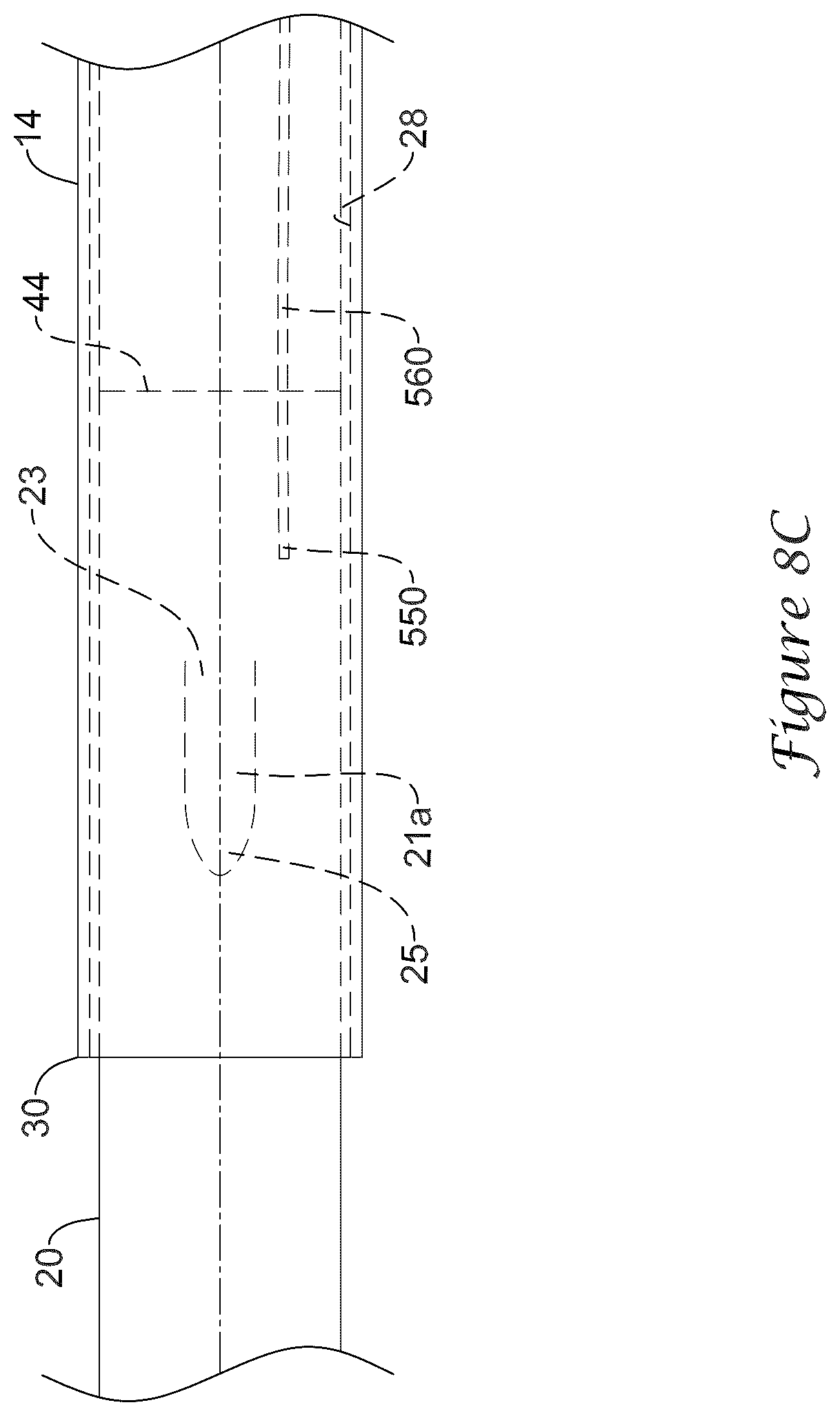 Patent US12318317 Figure 20 – Stent delivery system having retention structure