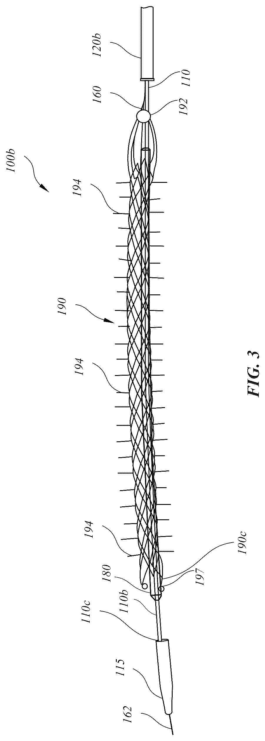 Patent US12318318 Figure 3 – Delivery systems for stents having protruding features