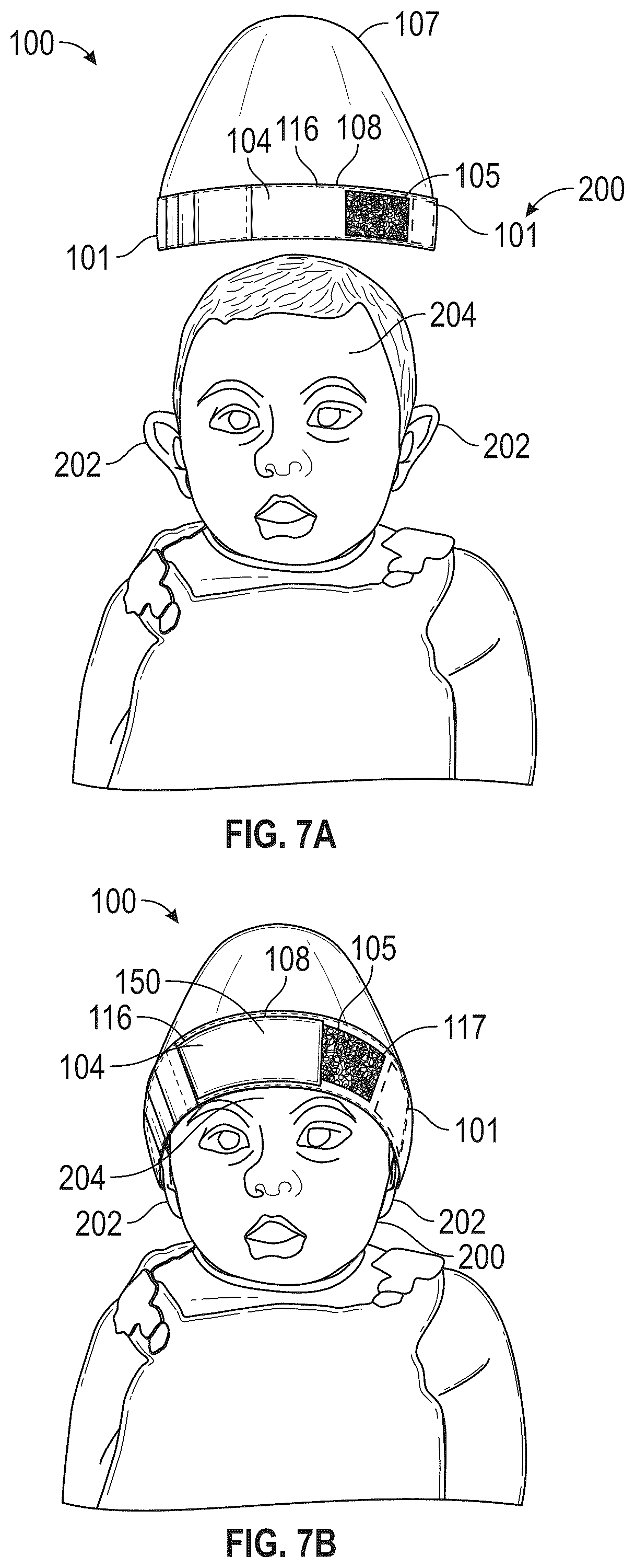 Patent US12318319 Figure 3 – Compression band for mittens and ears