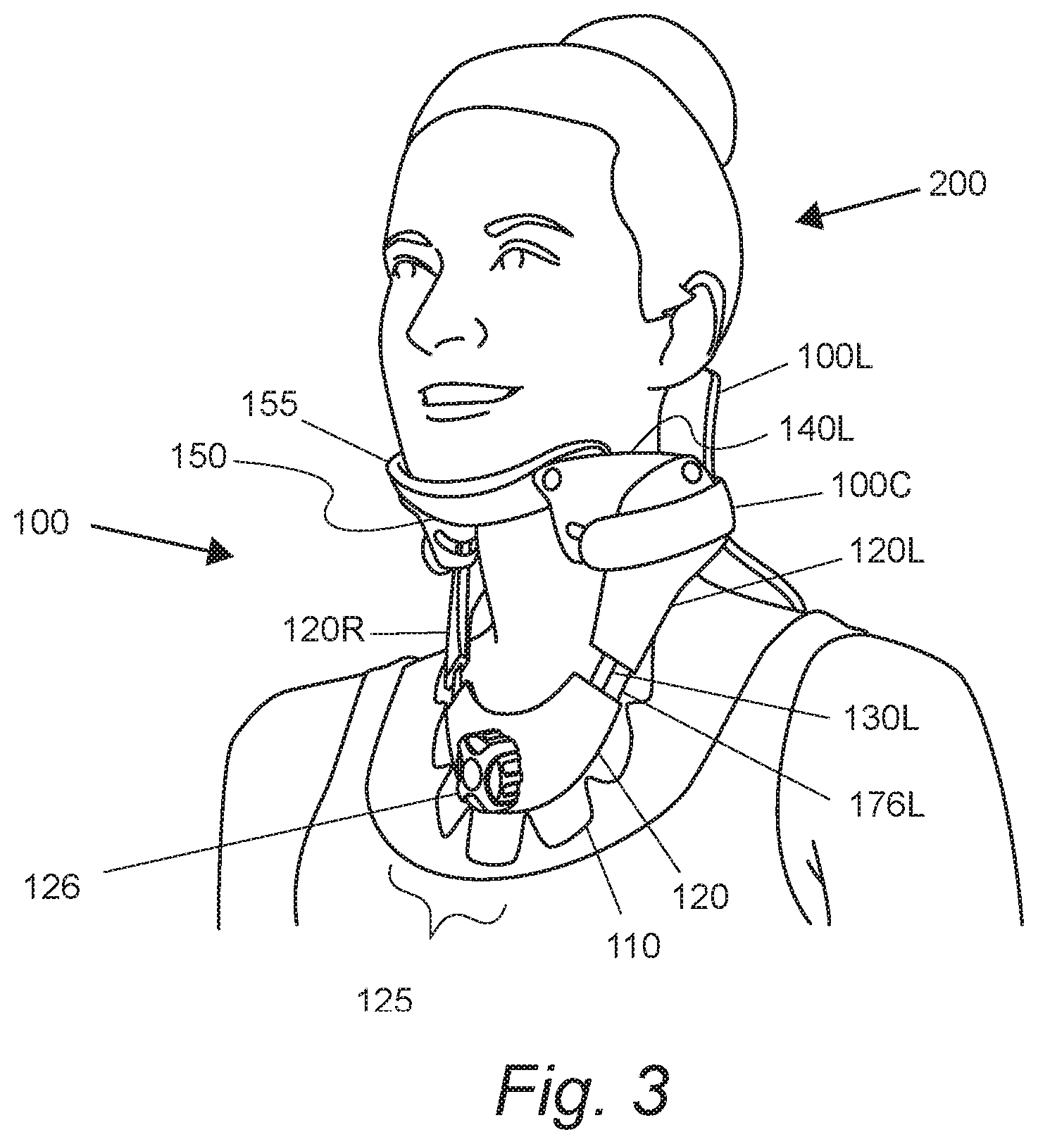 Patent US12318322 Figure 4 – Orthopedic neck brace with sliding pivot chin support