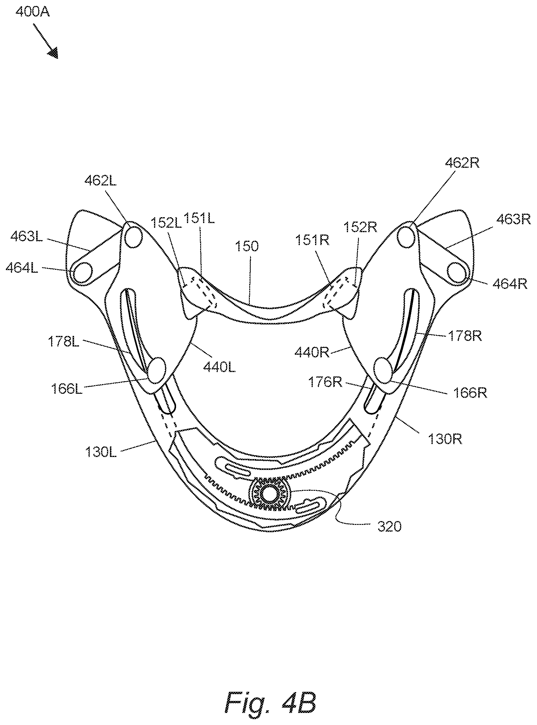 Patent US12318322 Figure 6 – Orthopedic neck brace with sliding pivot chin support