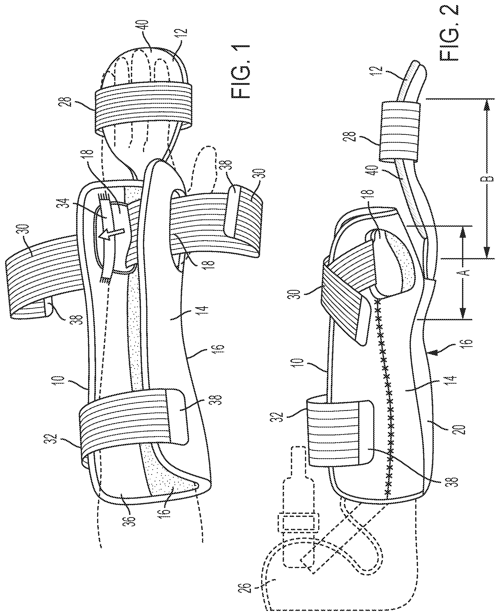 Patent US12318323 Figure 1 – Extendable fracture orthosis