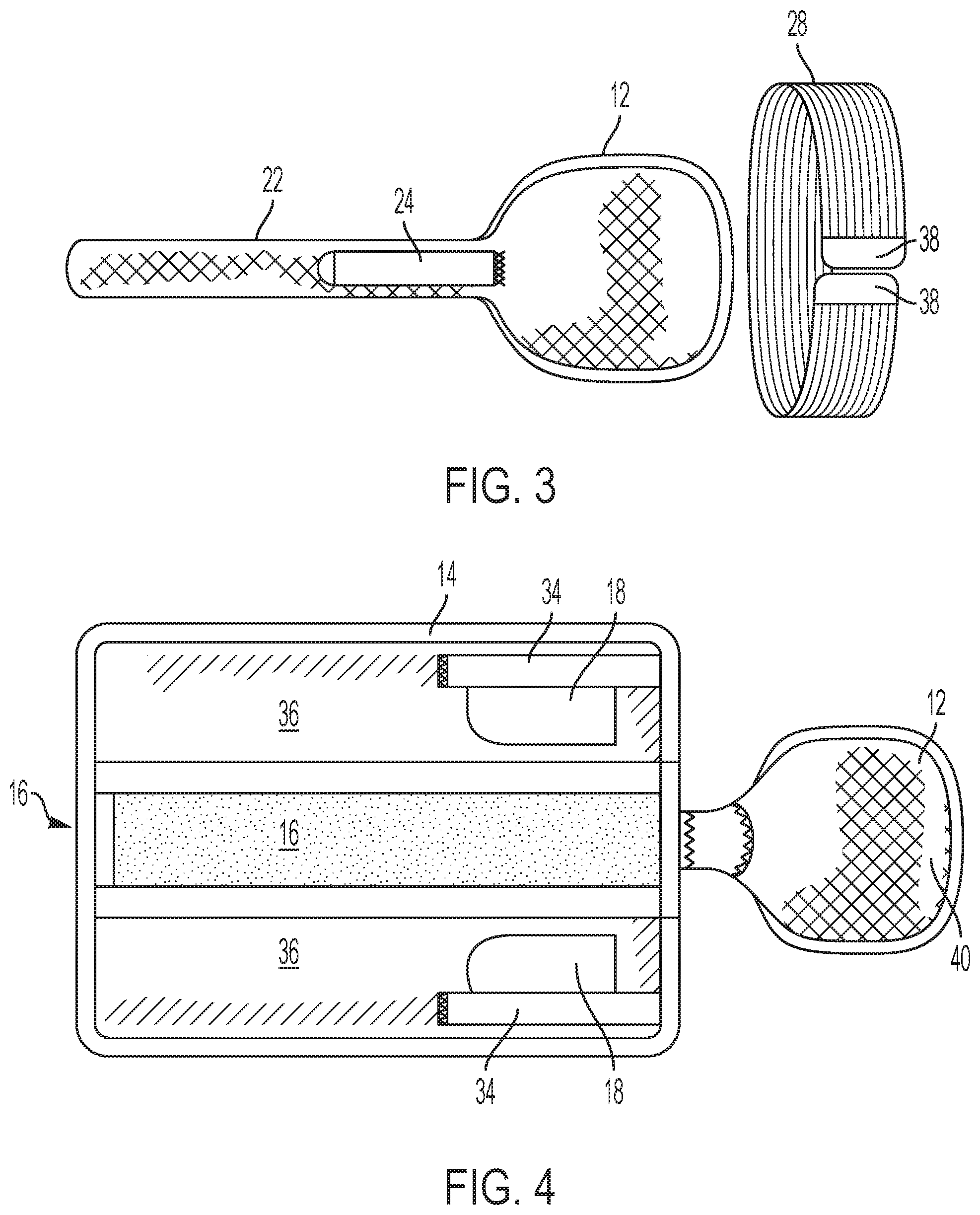 Patent US12318323 Figure 2 – Extendable fracture orthosis