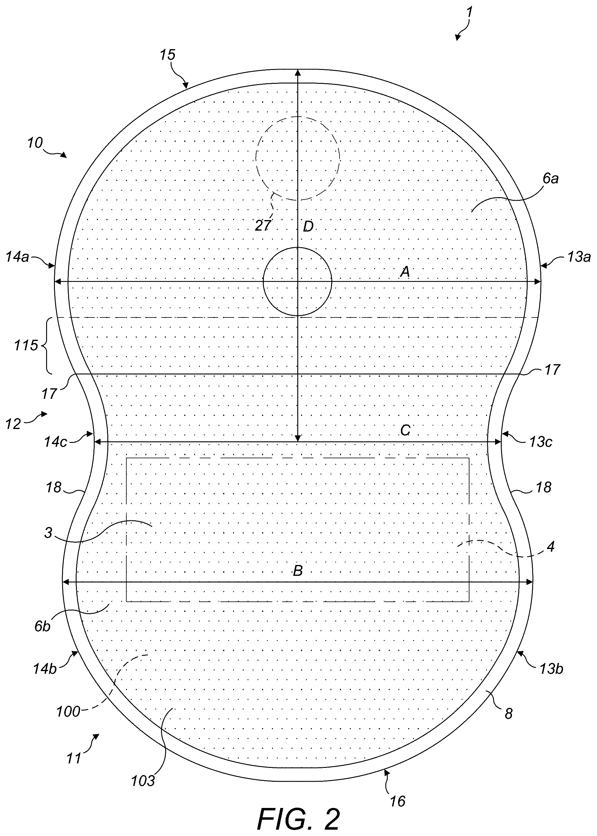 Patent US12318324 Figure 2 – Ostomy appliance