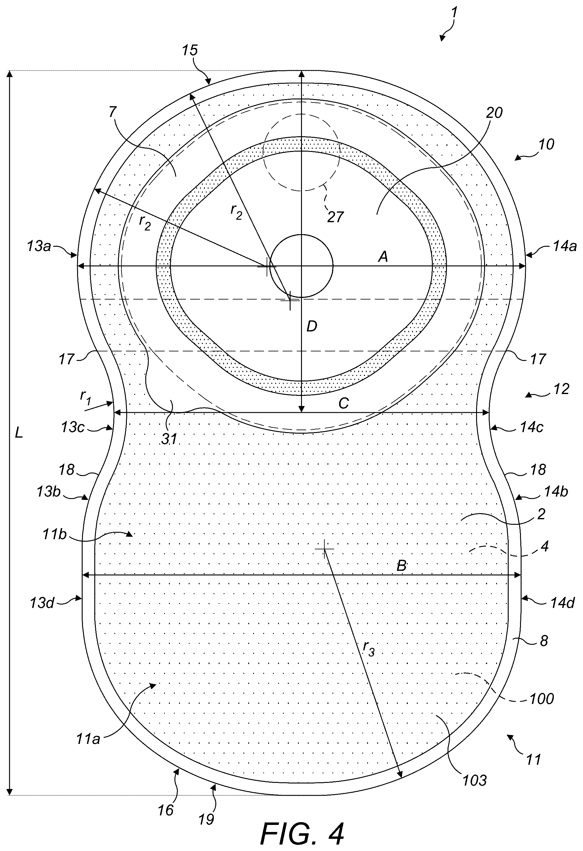 Patent US12318324 Figure 4 – Ostomy appliance