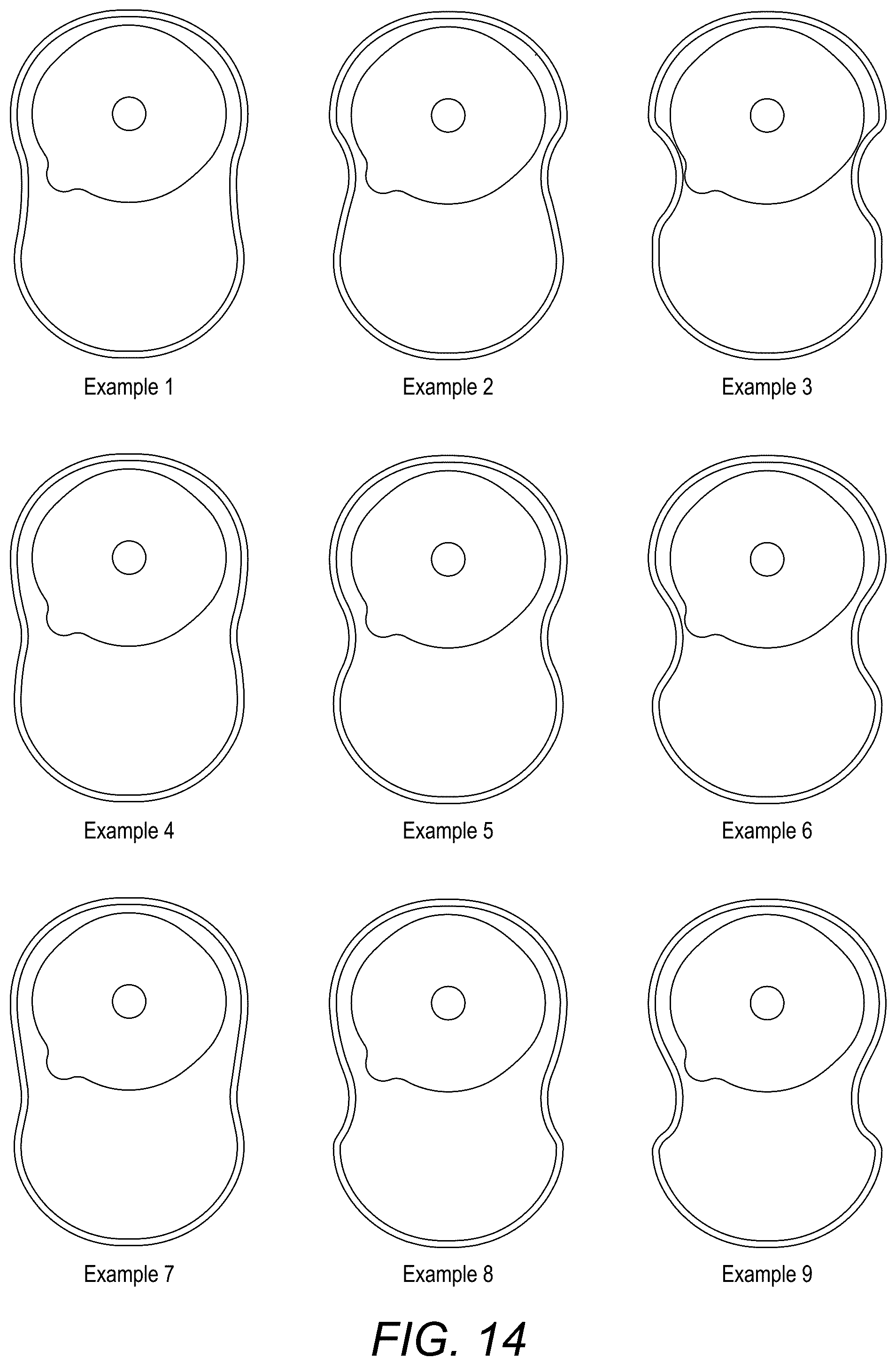 Patent US12318324 Figure 16 – Ostomy appliance