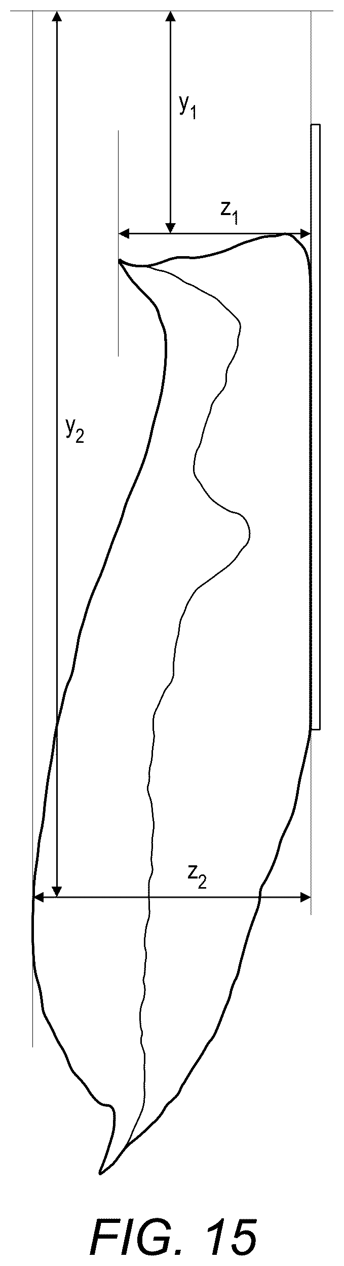 Patent US12318324 Figure 17 – Ostomy appliance