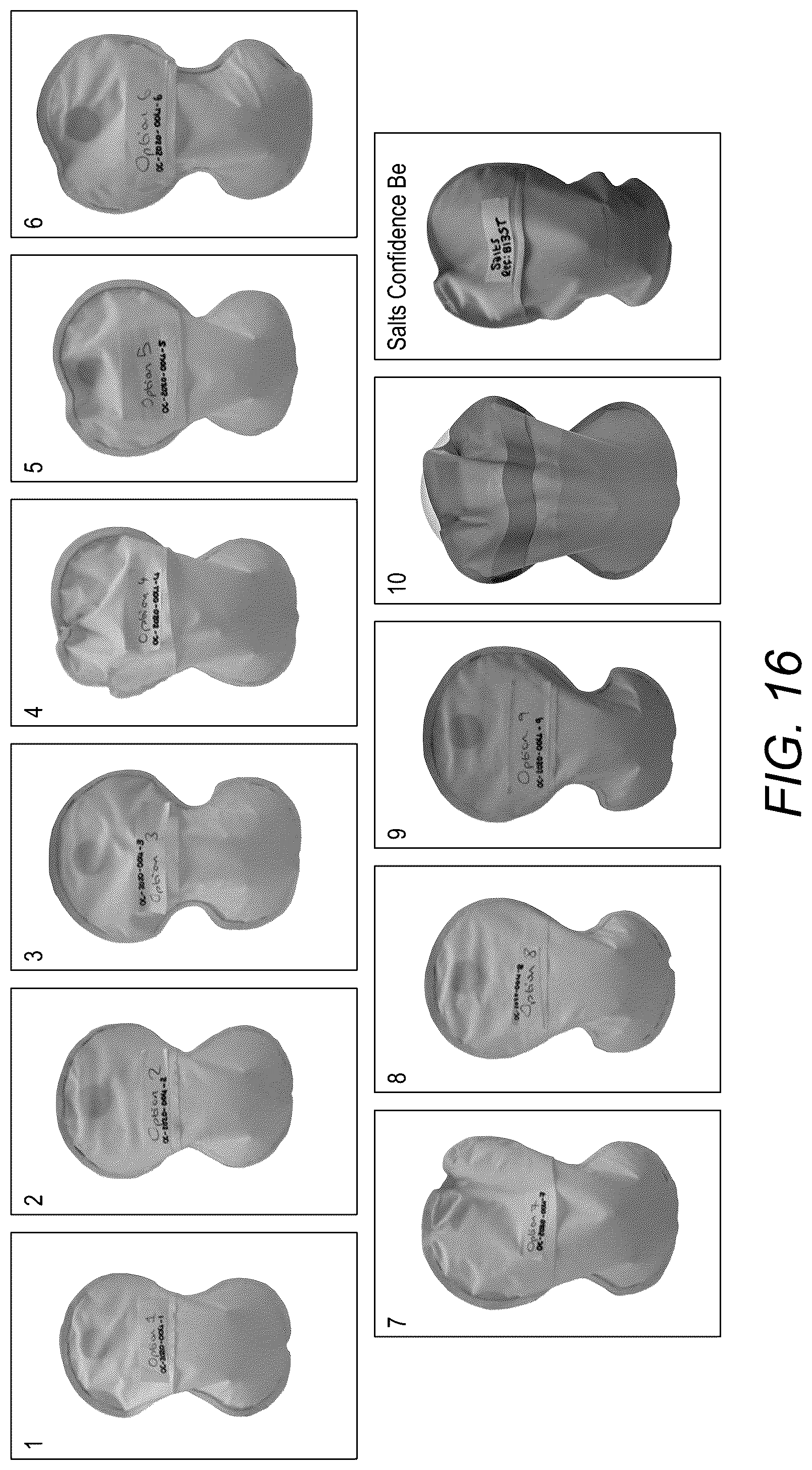 Patent US12318324 Figure 18 – Ostomy appliance