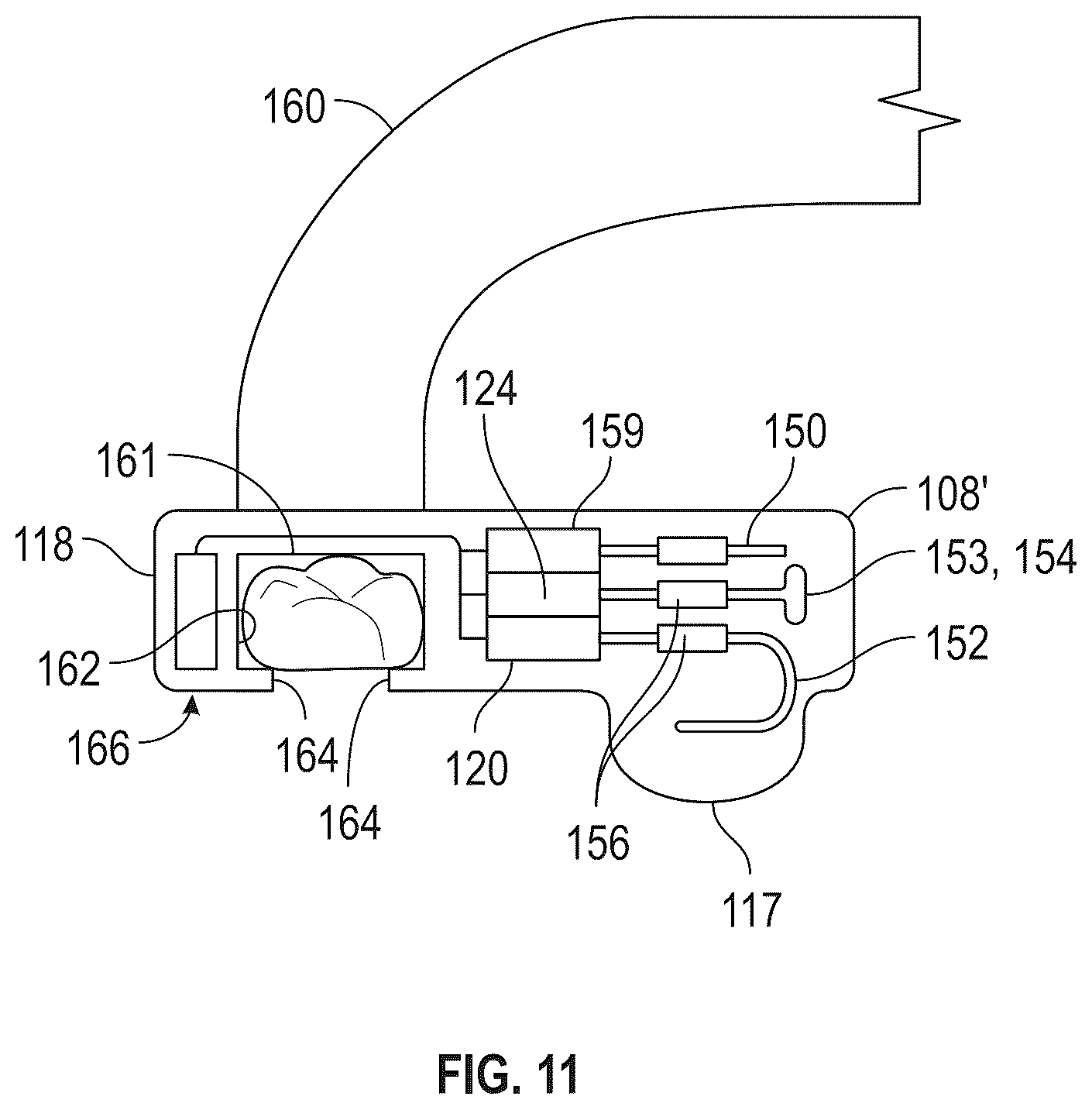 Patent US12318325 Figure 6 – Maxillary and mandibular devices that prevent disengagement therebetween, controller station, and methods of treating and/or diagnosing medical disorders