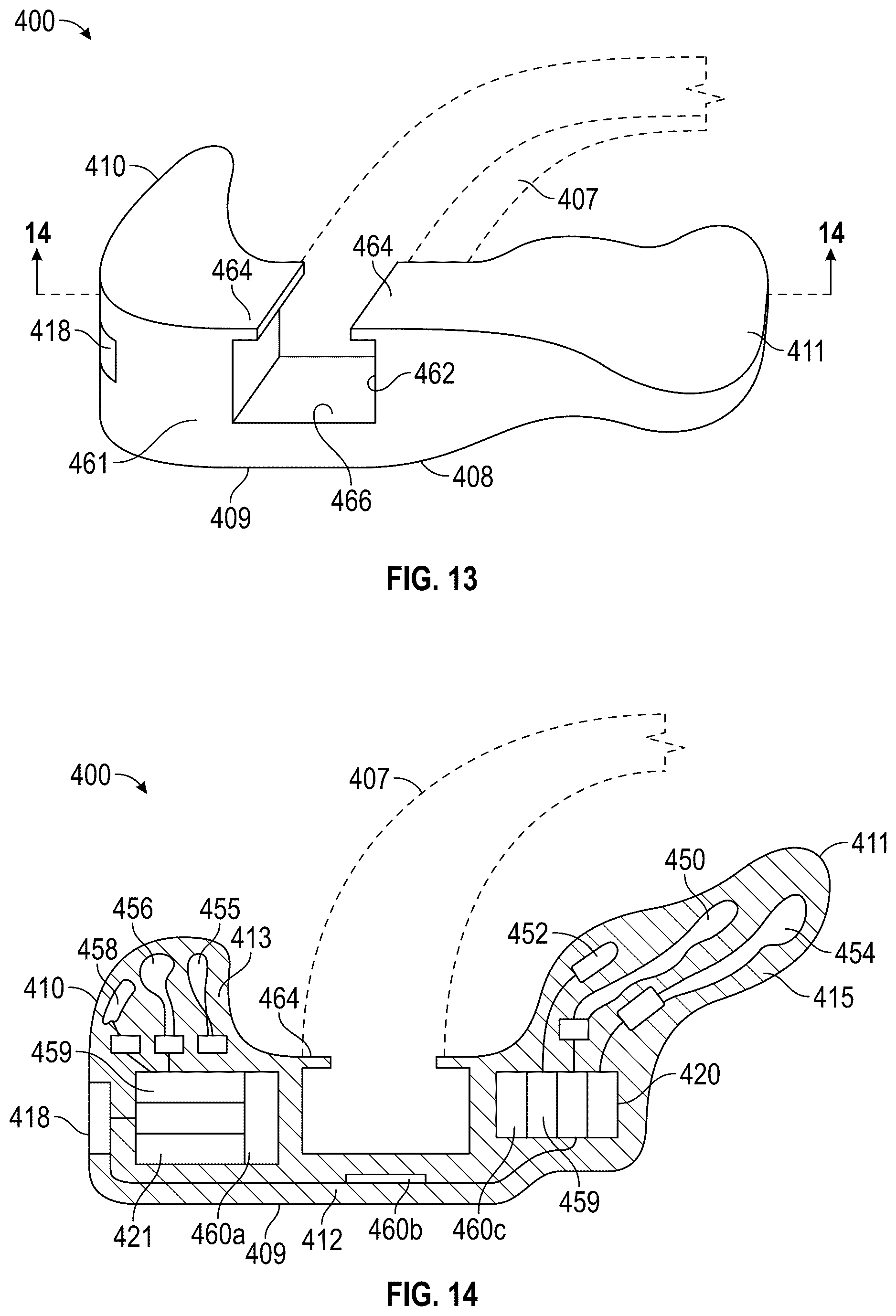 Patent US12318325 Figure 8 – Maxillary and mandibular devices that prevent disengagement therebetween, controller station, and methods of treating and/or diagnosing medical disorders